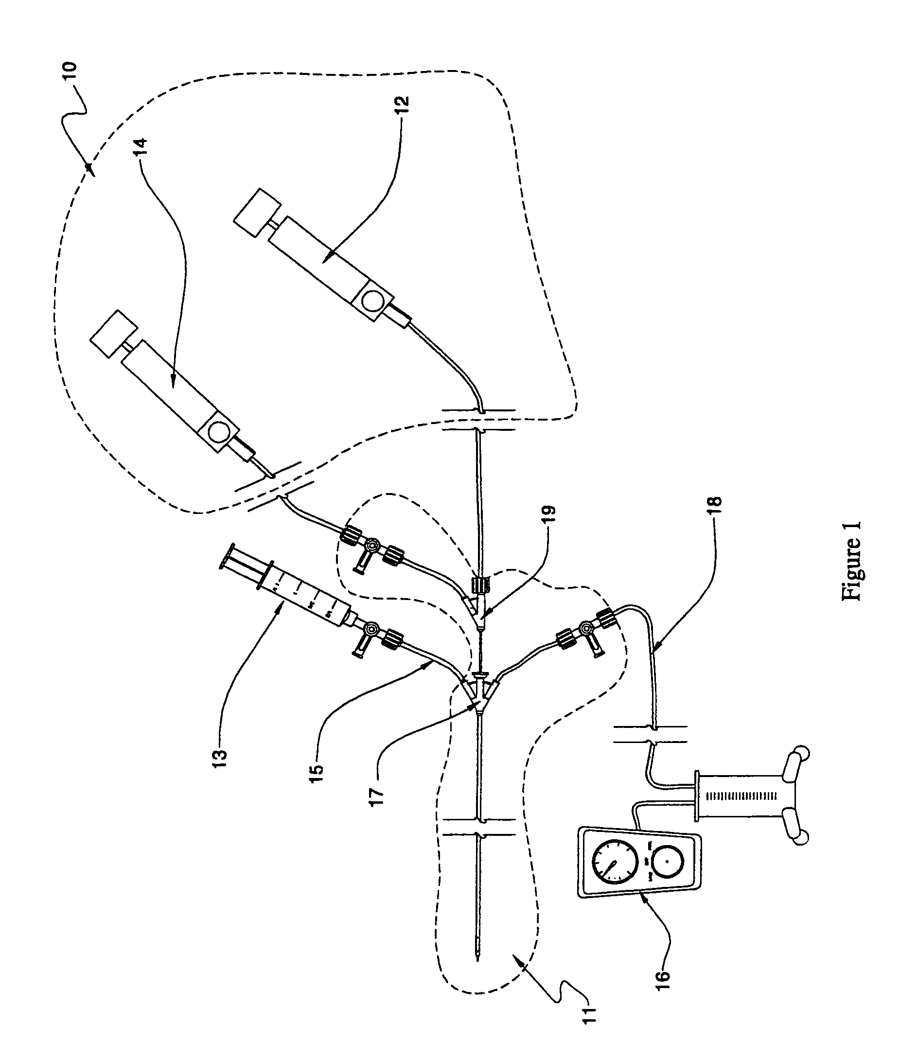 Fluid delivery systems for delivering fluids to multi-lumen catheters