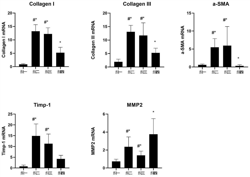 Application of lithocholic acid (LCA) in preparation of drug for relieving liver fibrosis