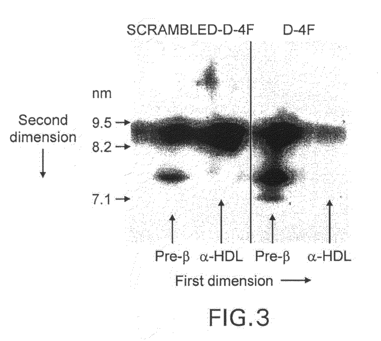 Synthetic apolipoprotein e mimicking polypeptides and methods of use