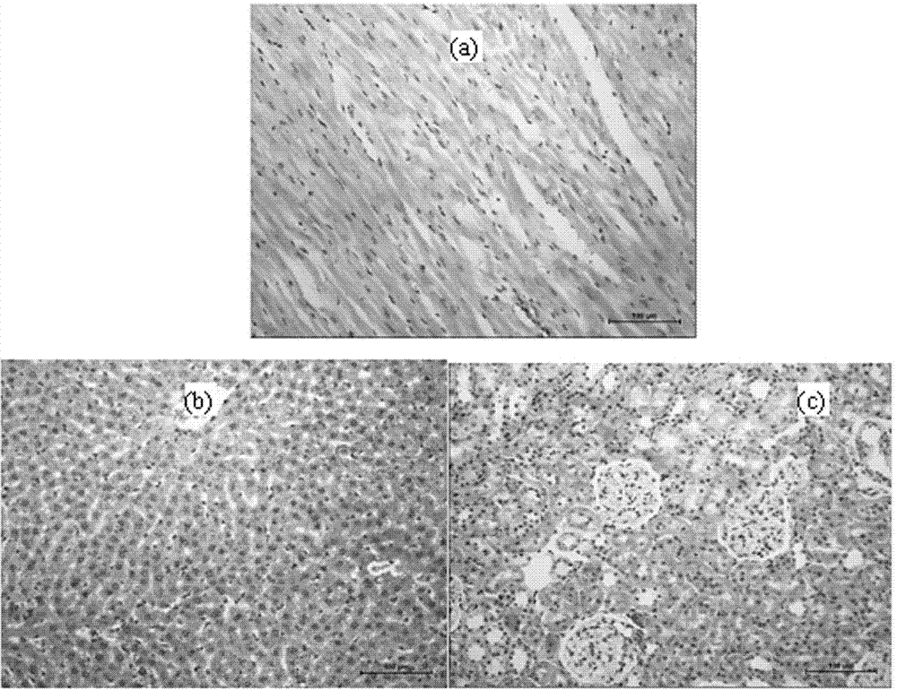 Medical biodegradable zinc alloy and preparation method thereof