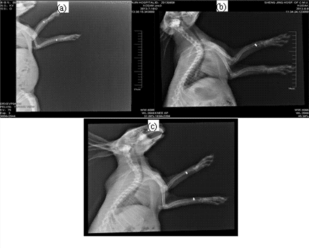 Medical biodegradable zinc alloy and preparation method thereof