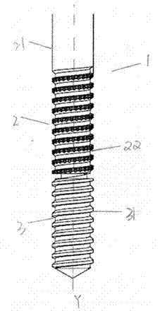 Spine screw