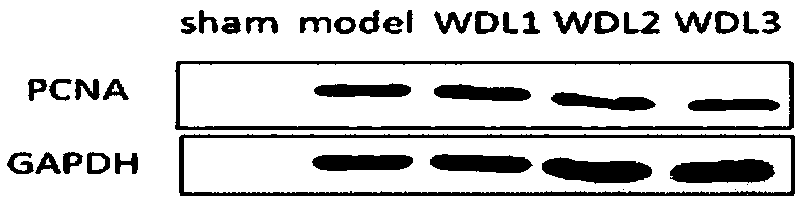 Wedelolactone pharmaceutical use