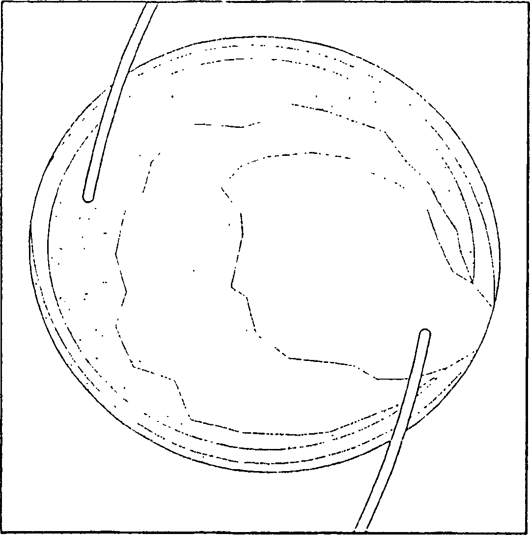 Light adjustable multifocal lenses