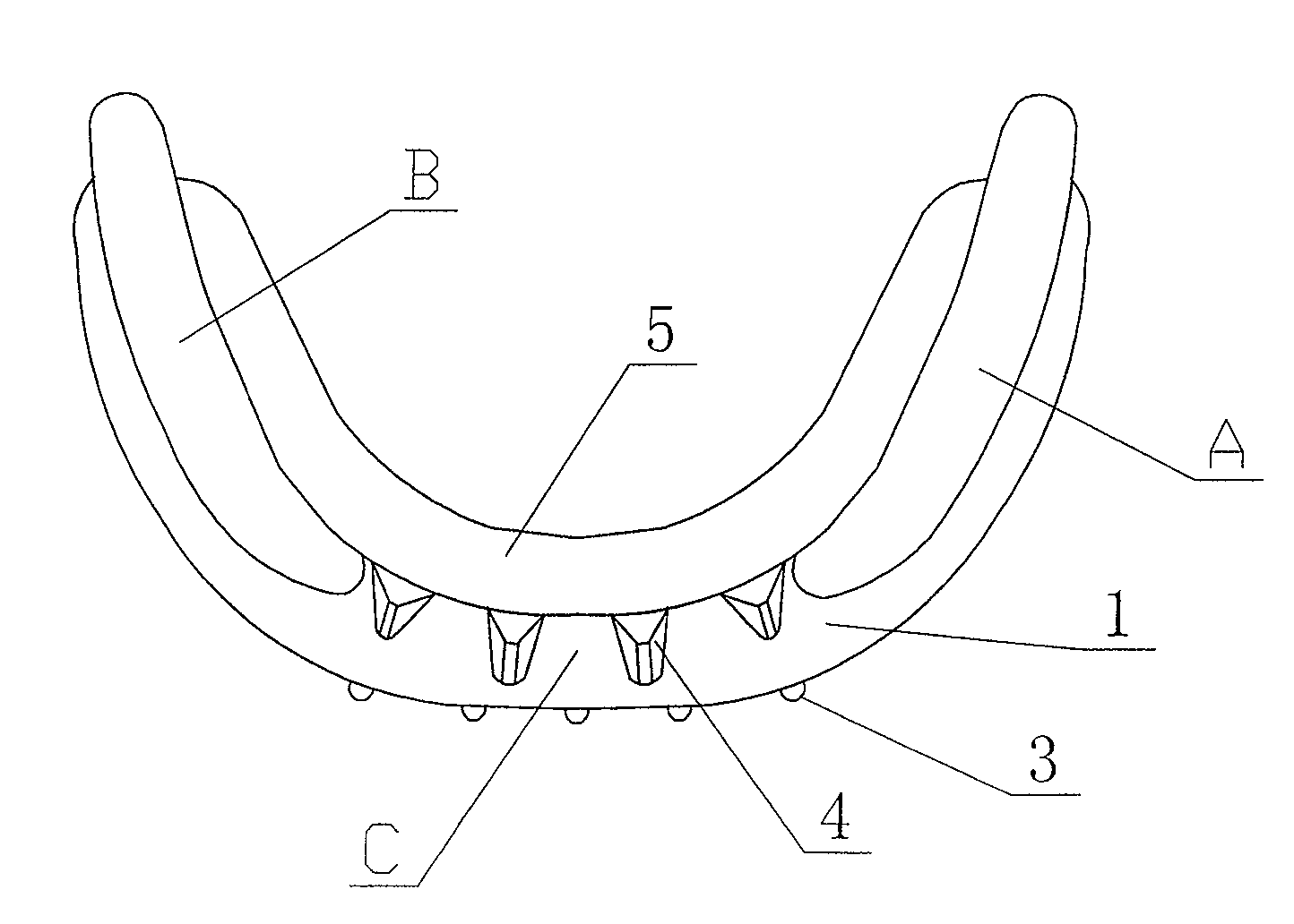 Anterior teeth cross-bite appliance