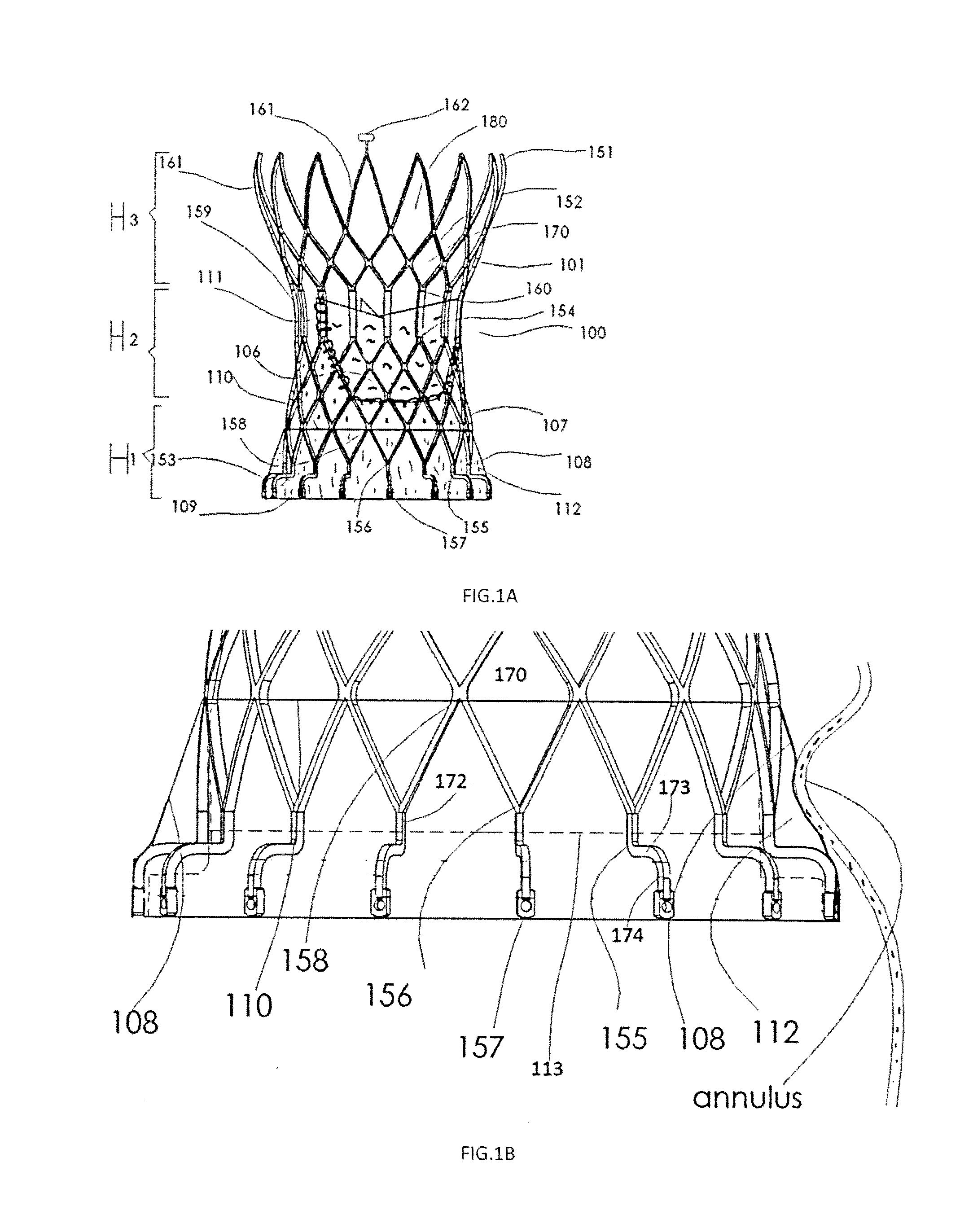 Aortic Replacement Valve