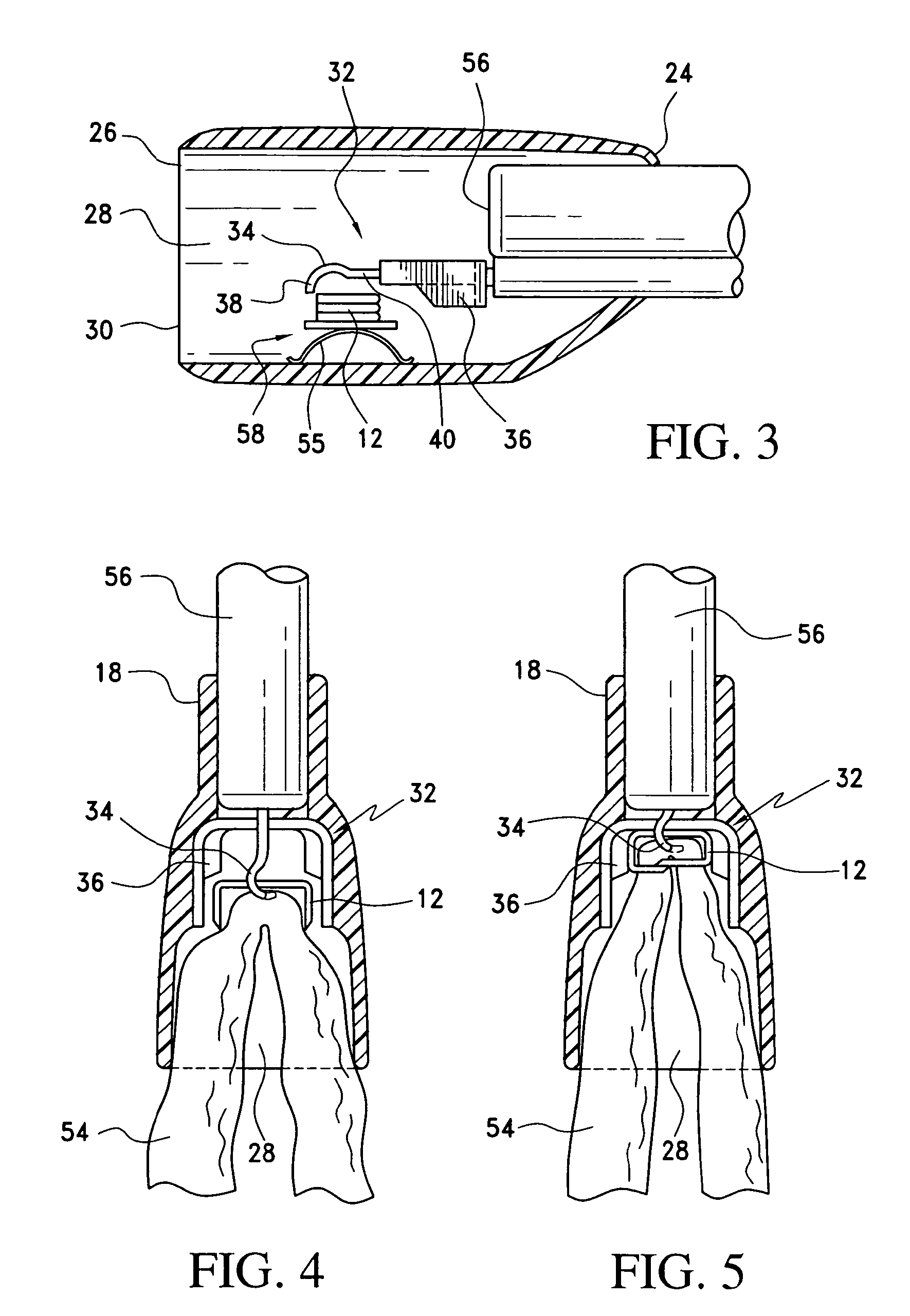 Method And Apparatus For Endoscopically Performing Gastric Reduction Surgery In A Single Pass