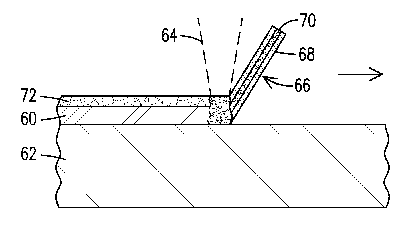 Laser microcladding using powdered flux and metal