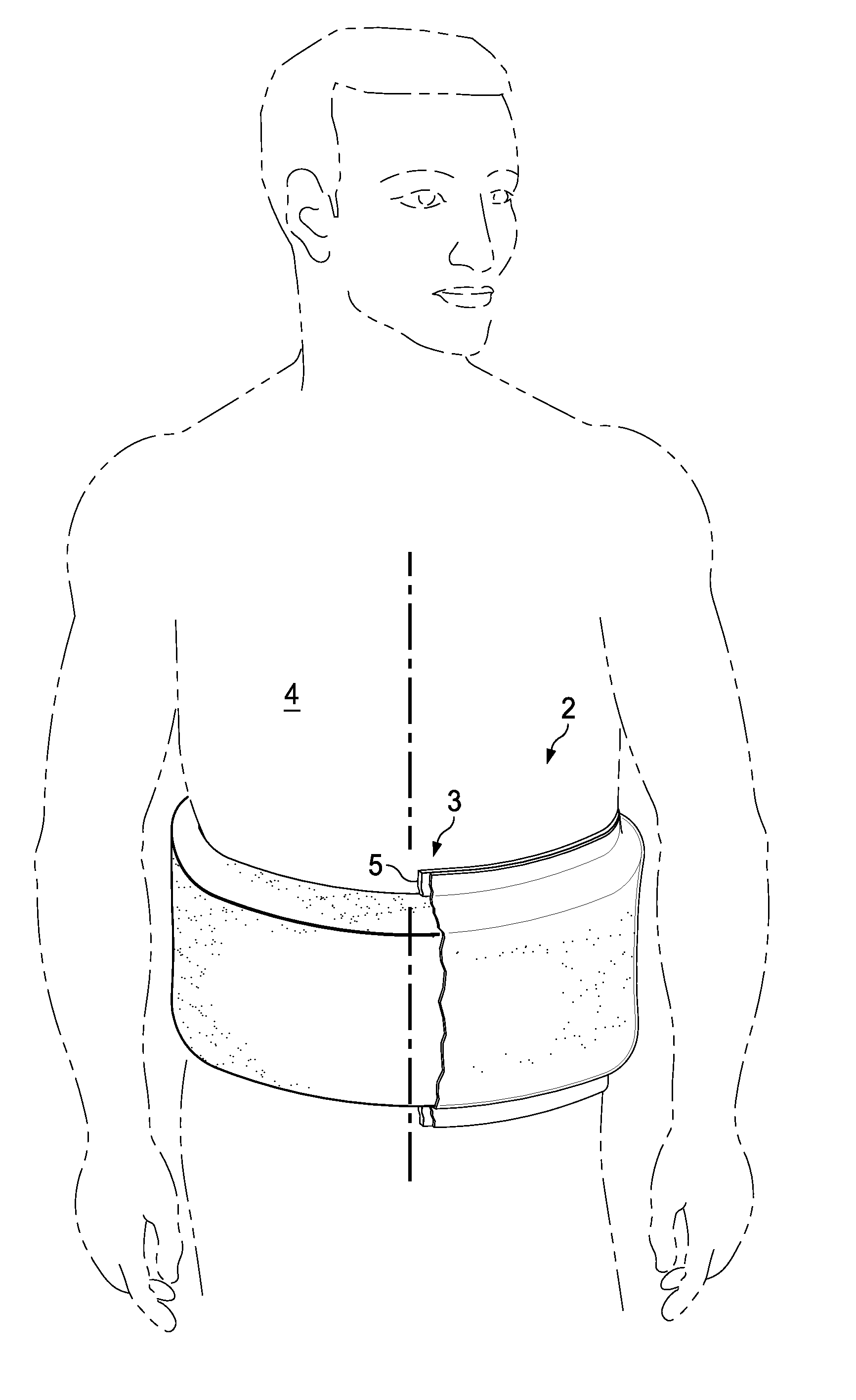 Reduced-pressure, compression systems and apparatuses for use on a curved body part