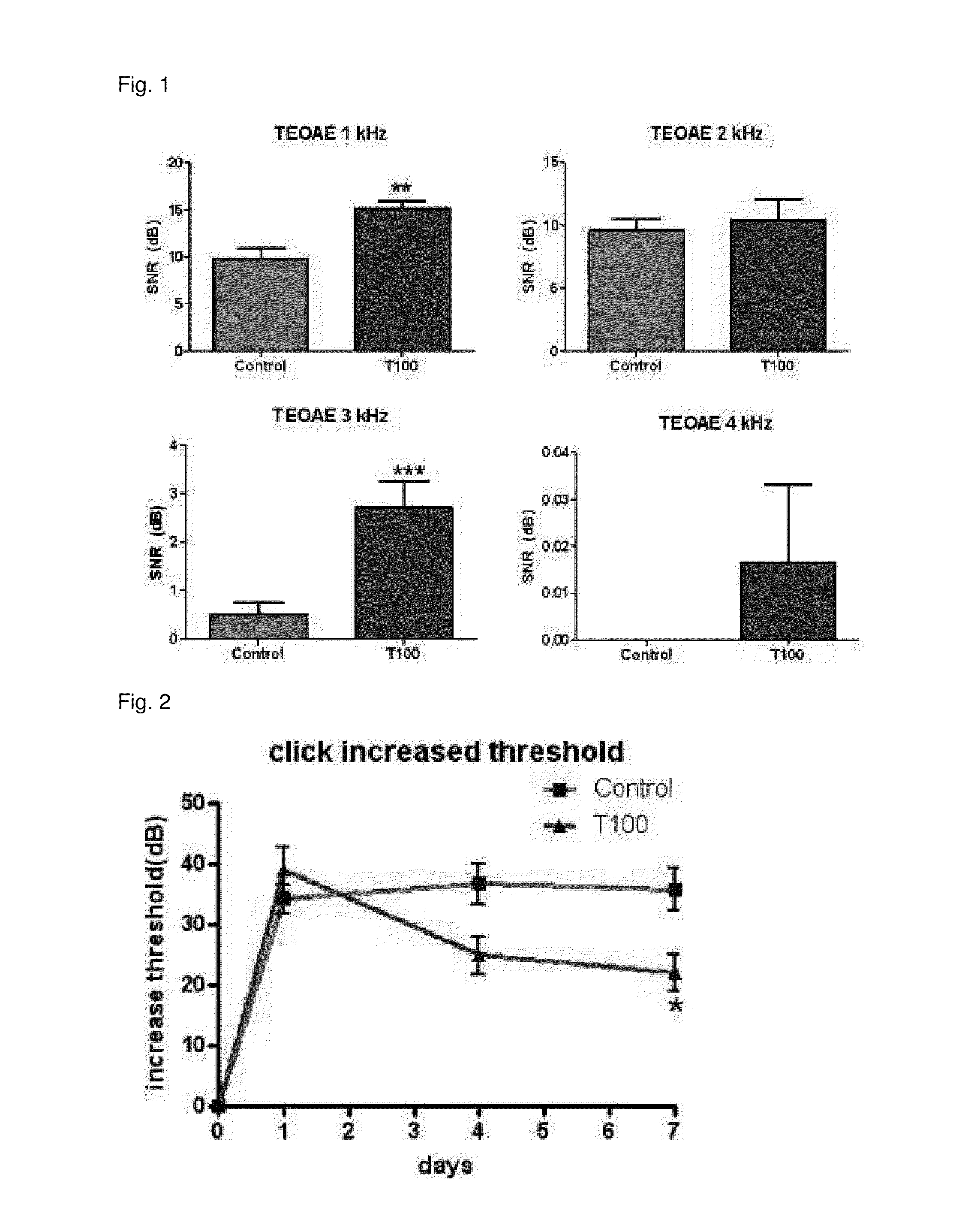 Composition for preventing or treating hearing loss