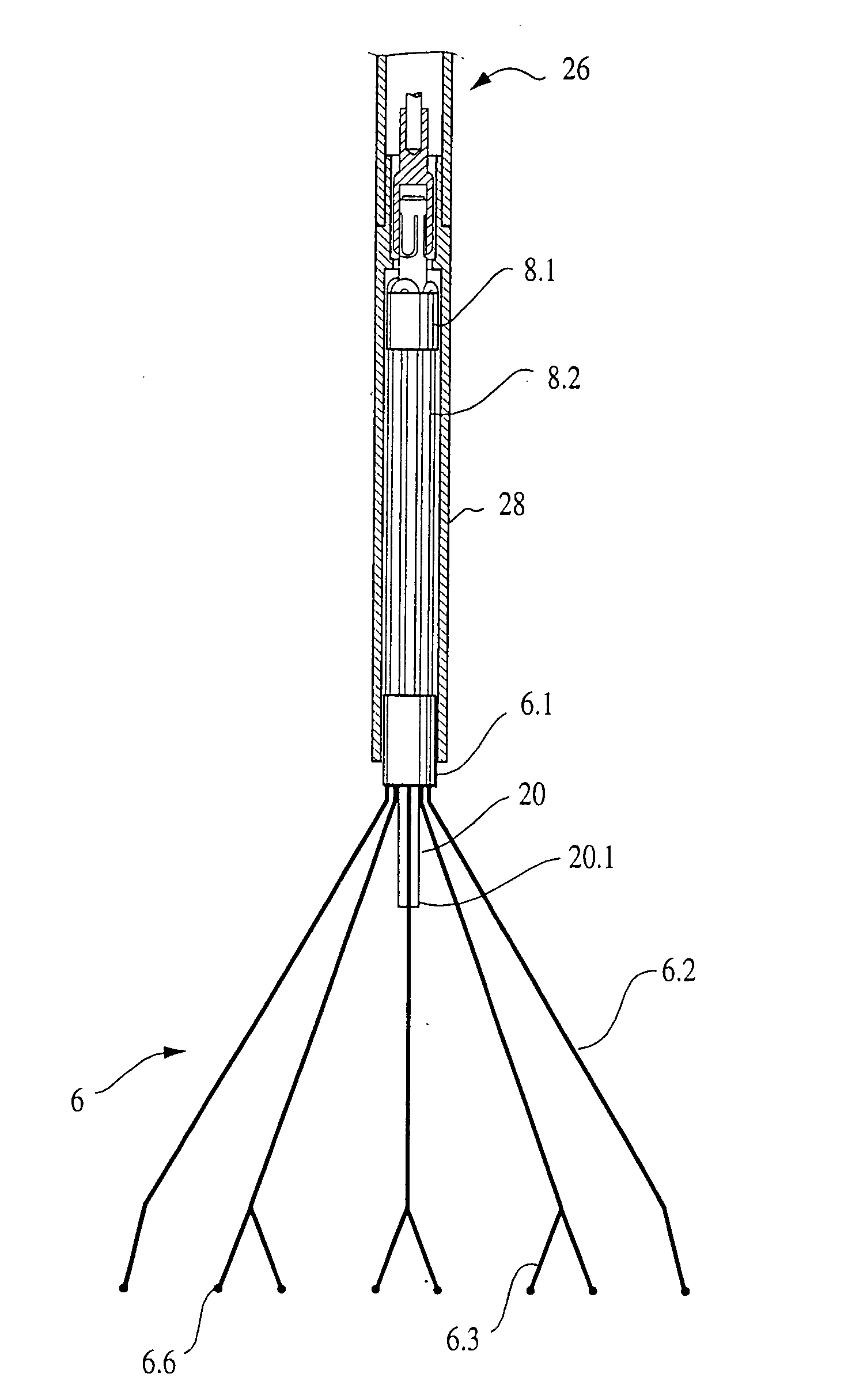 Body vessel filter