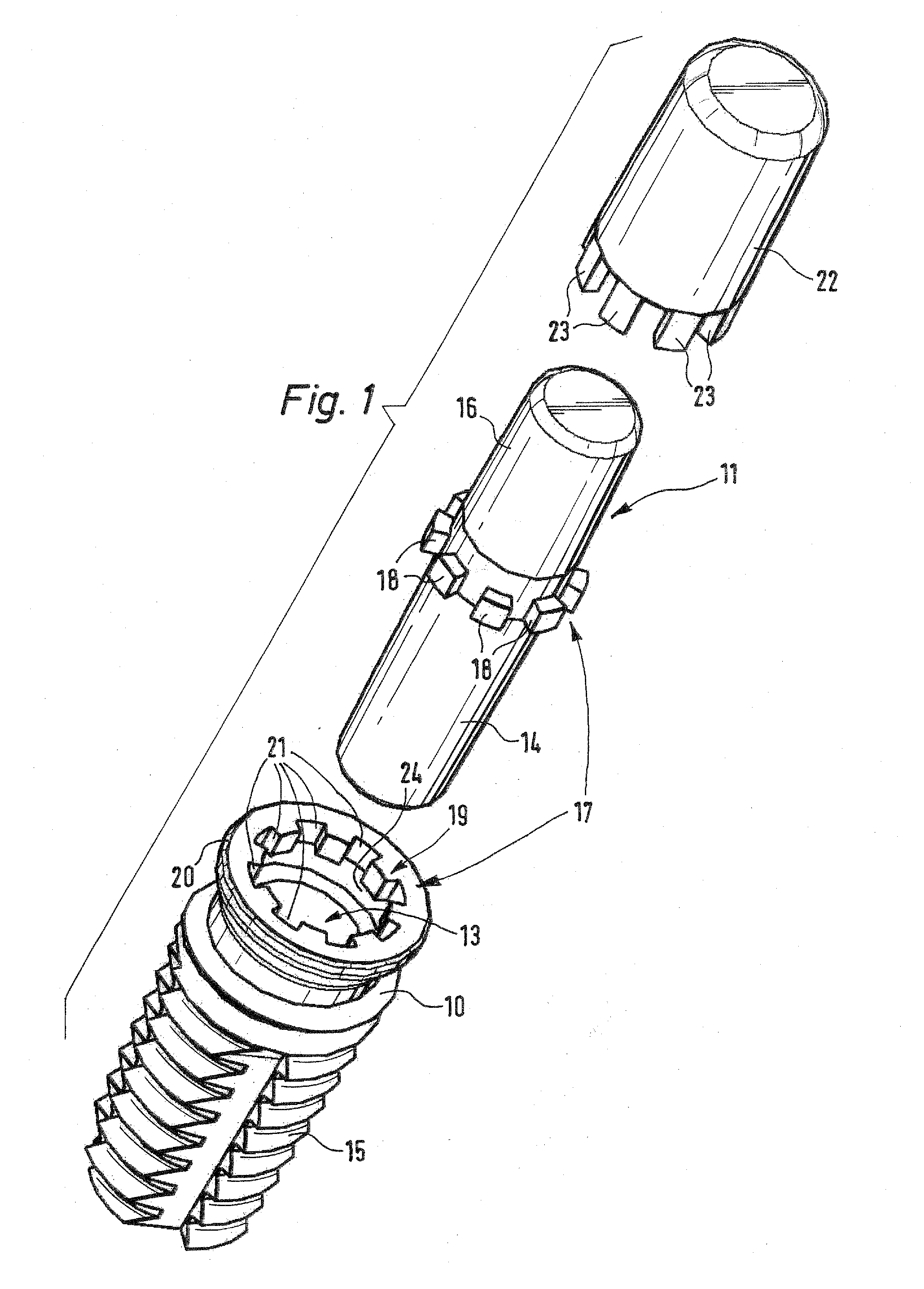 Dental implant, in particular or ceramic material