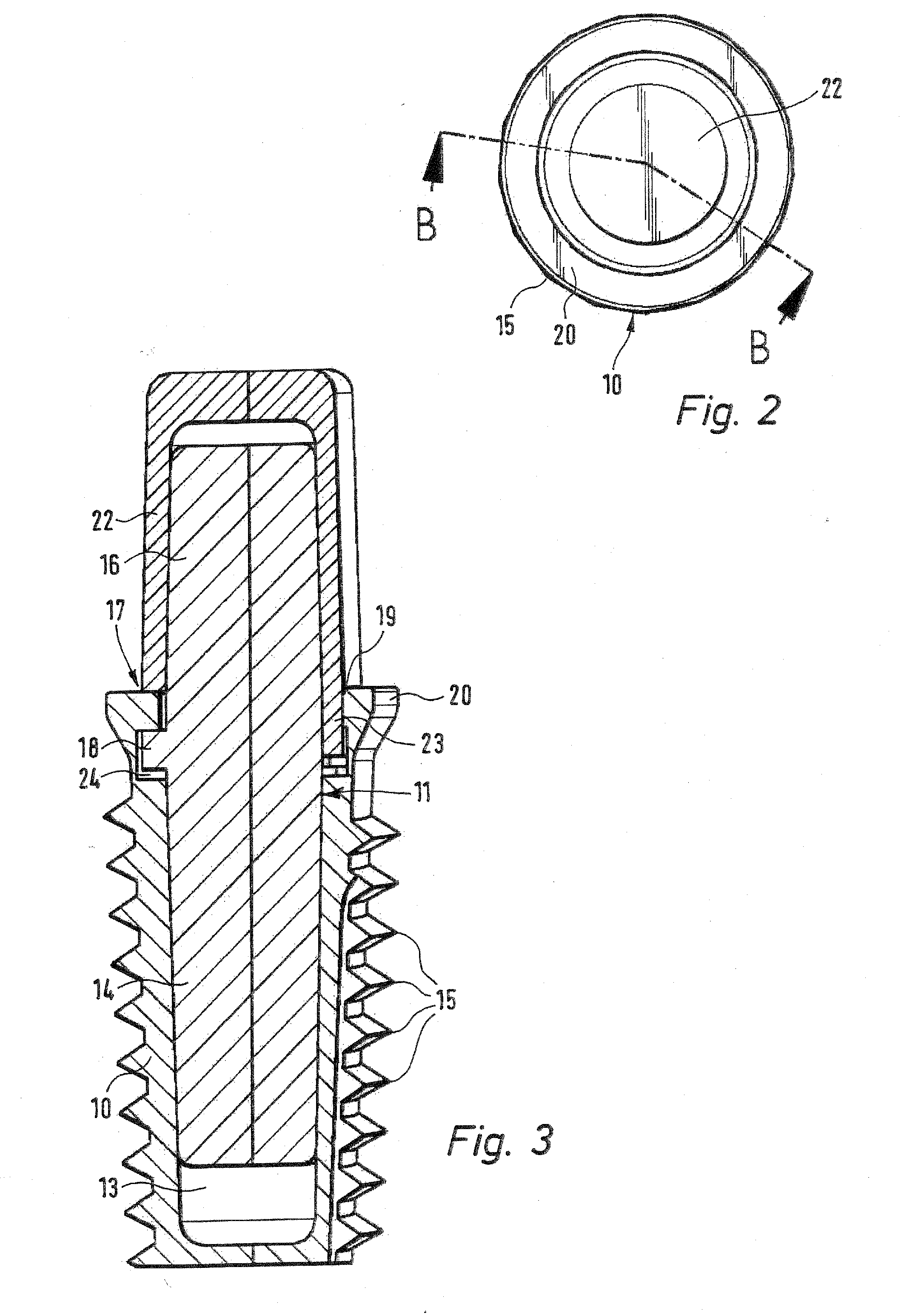 Dental implant, in particular or ceramic material