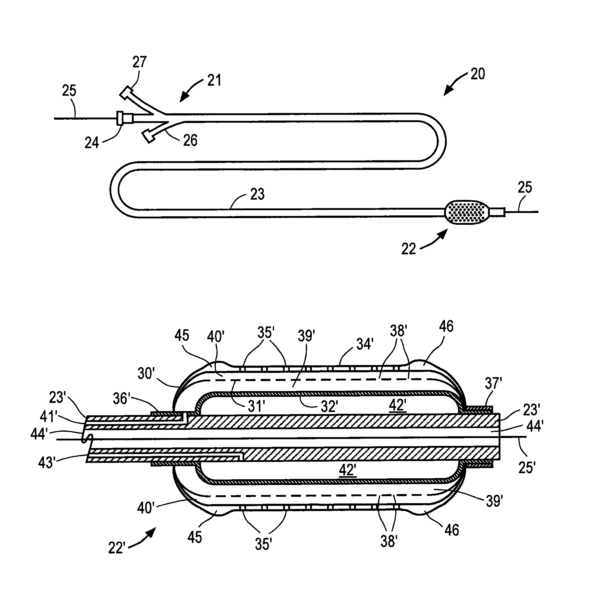 Apparatus and method for delivering intraluminal therapy