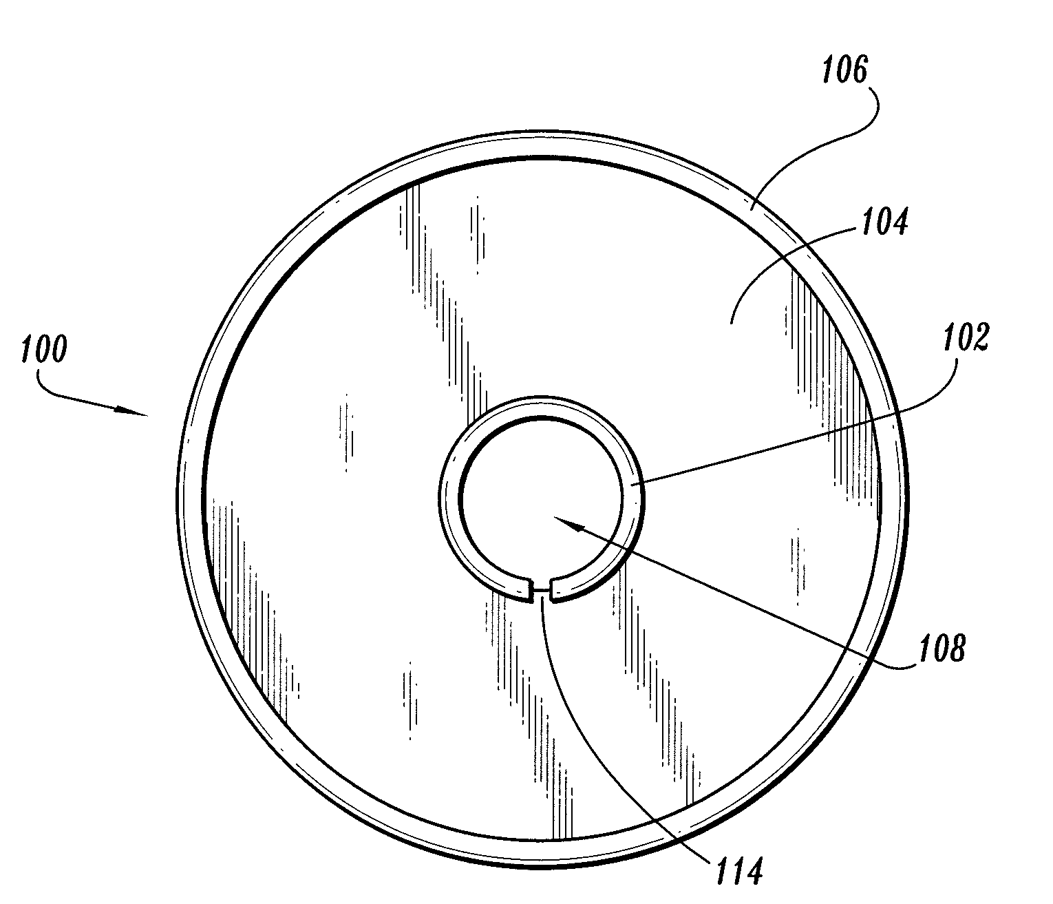 Anastomosis composite gasket