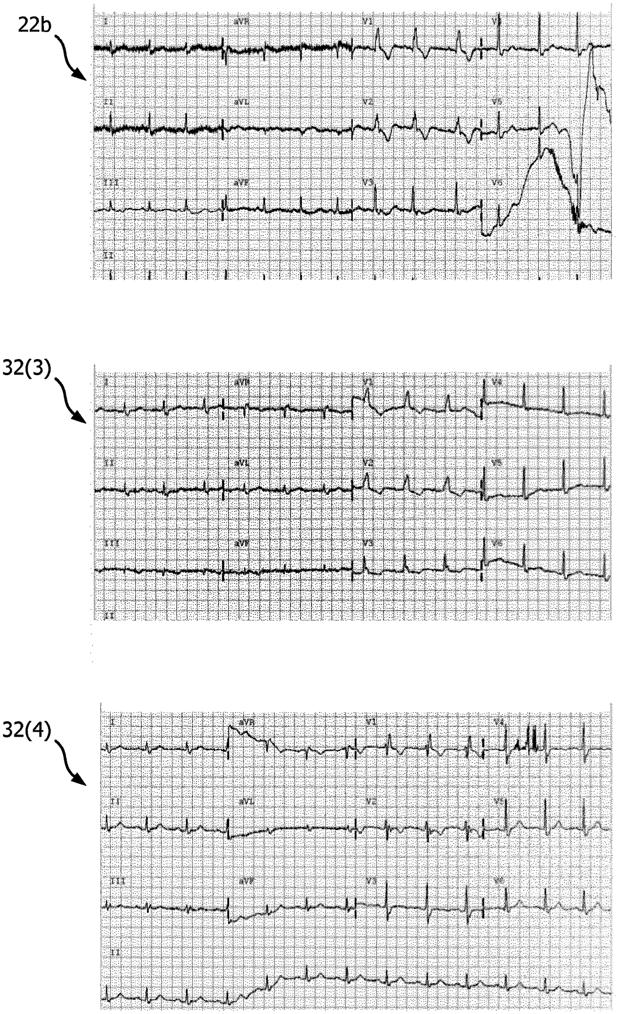 ECG training and skill enhancement