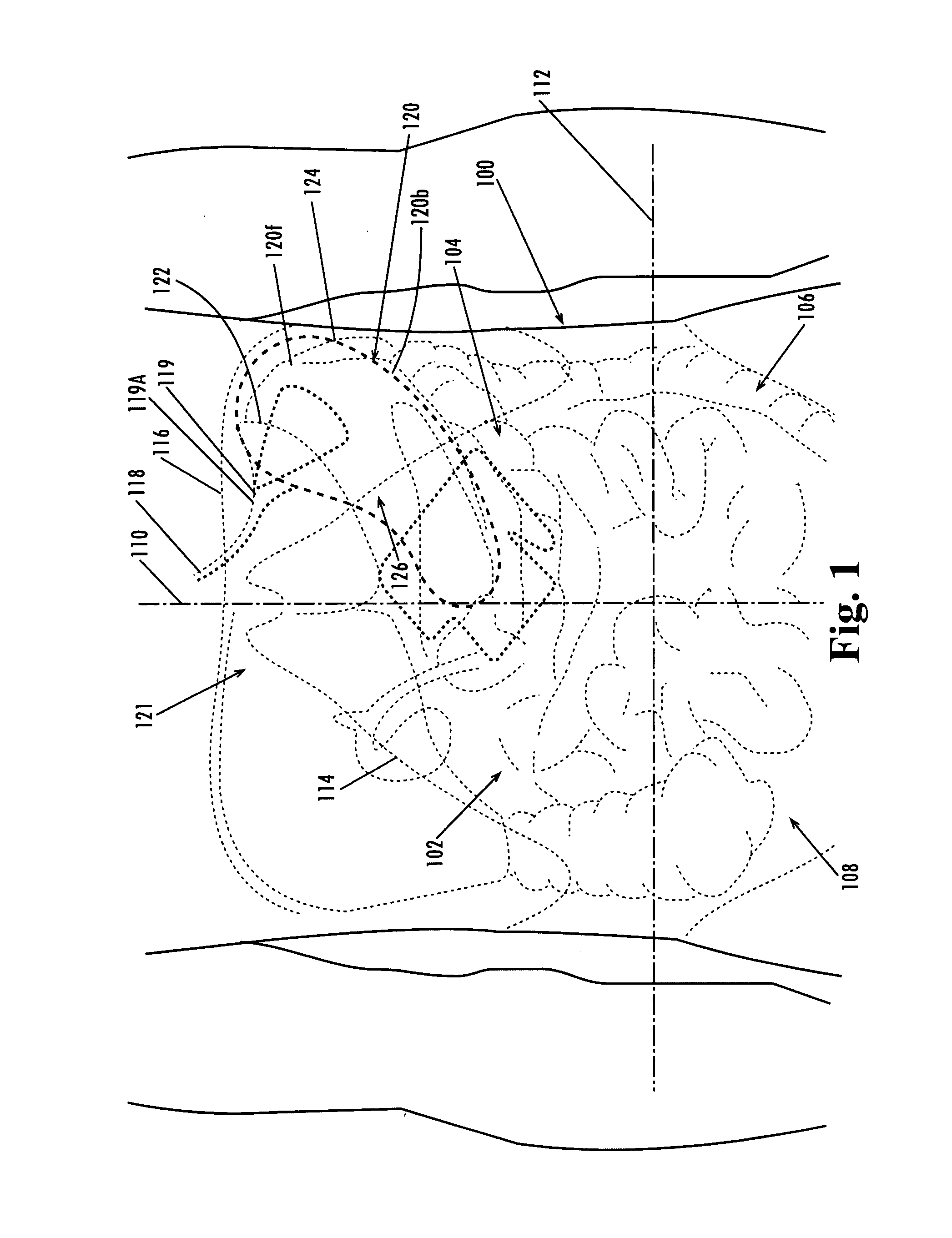 Devices and methods for treatment of obesity