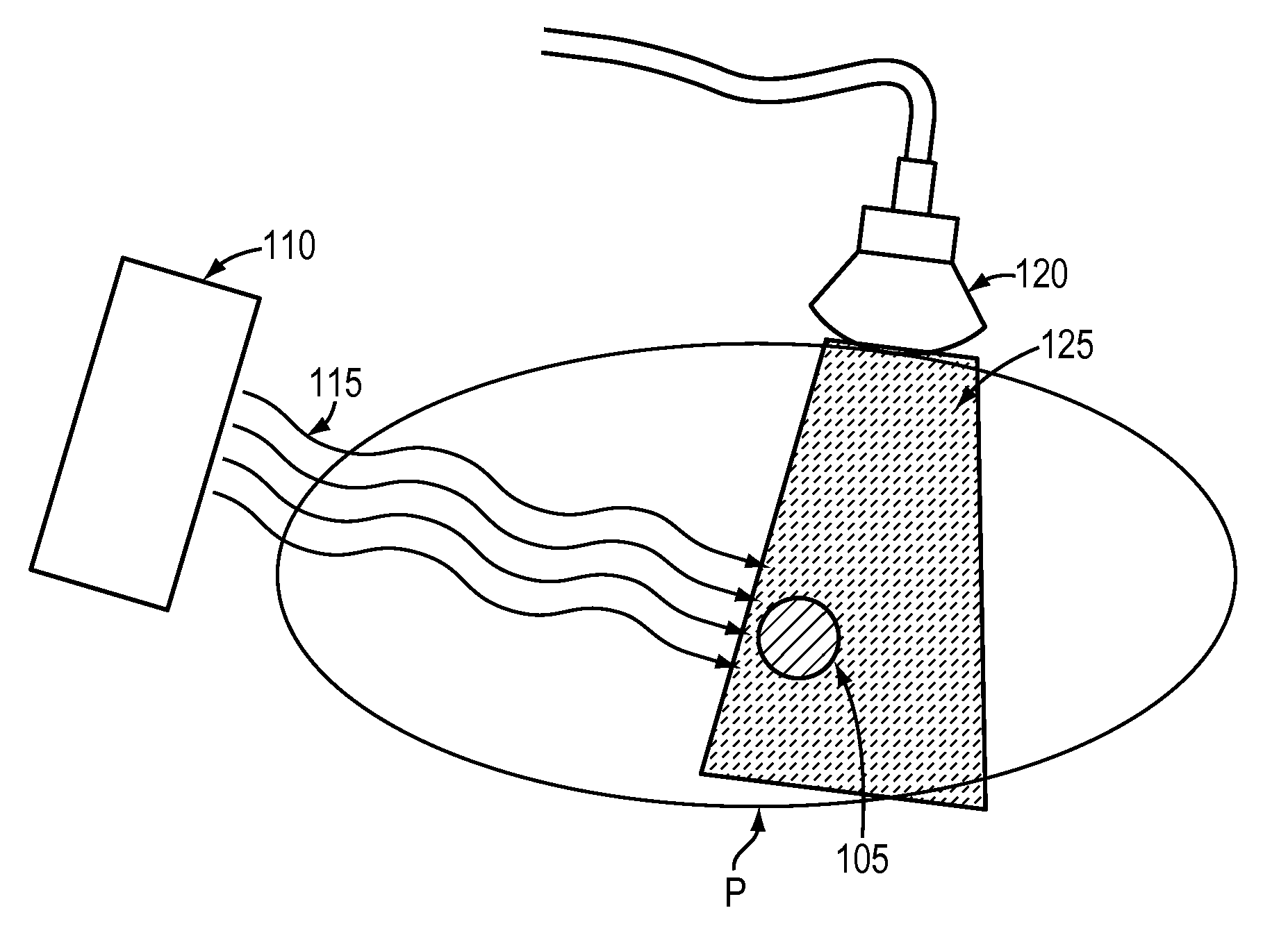 Adaptive radiotherapy treatment using ultrasound