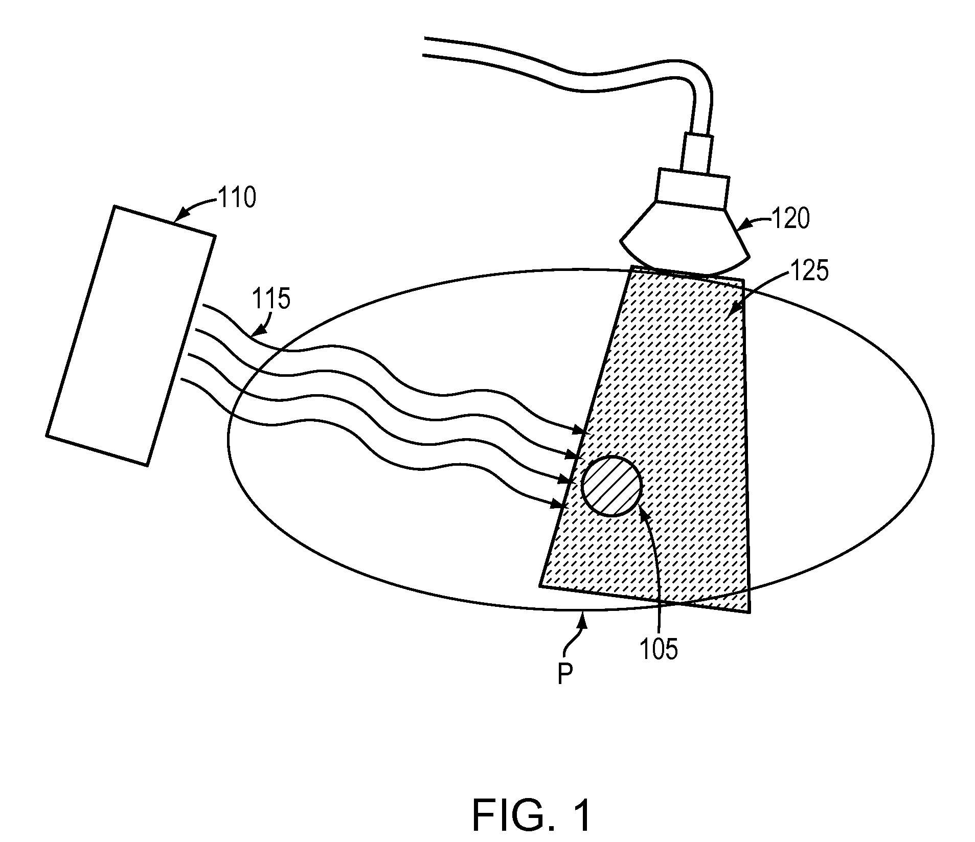 Adaptive radiotherapy treatment using ultrasound