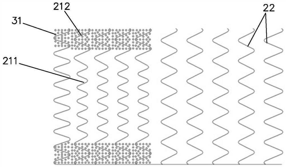 Novel covered intravascular stent used for aortic arch