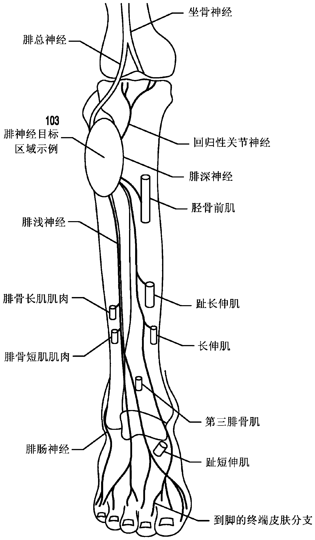 Restless leg syndrome or overactive nerve treatment