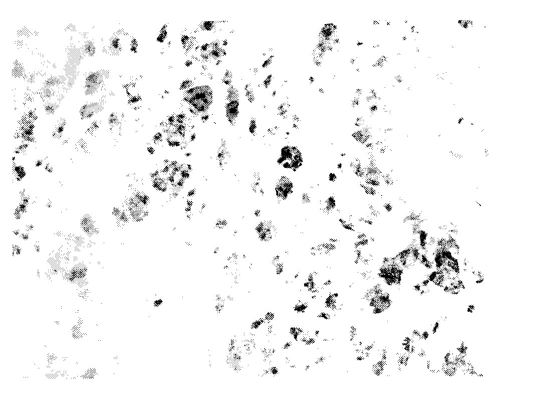 Preparation method of cohesive composite microsphere porous scaffolds