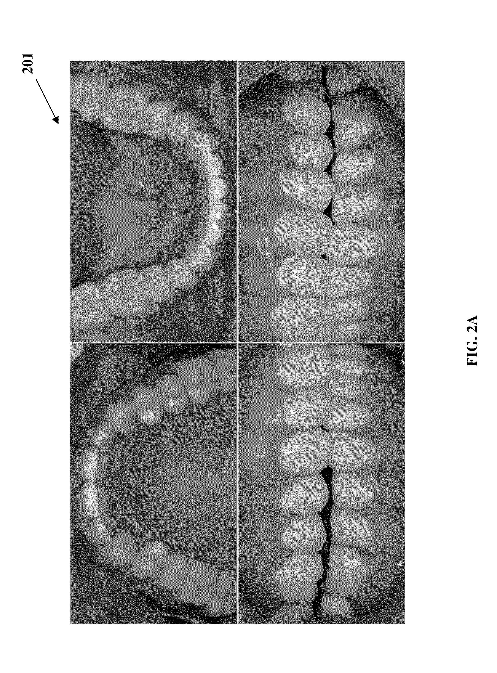 Computer-aided Fabrication Of A Removable Dental Prosthesis