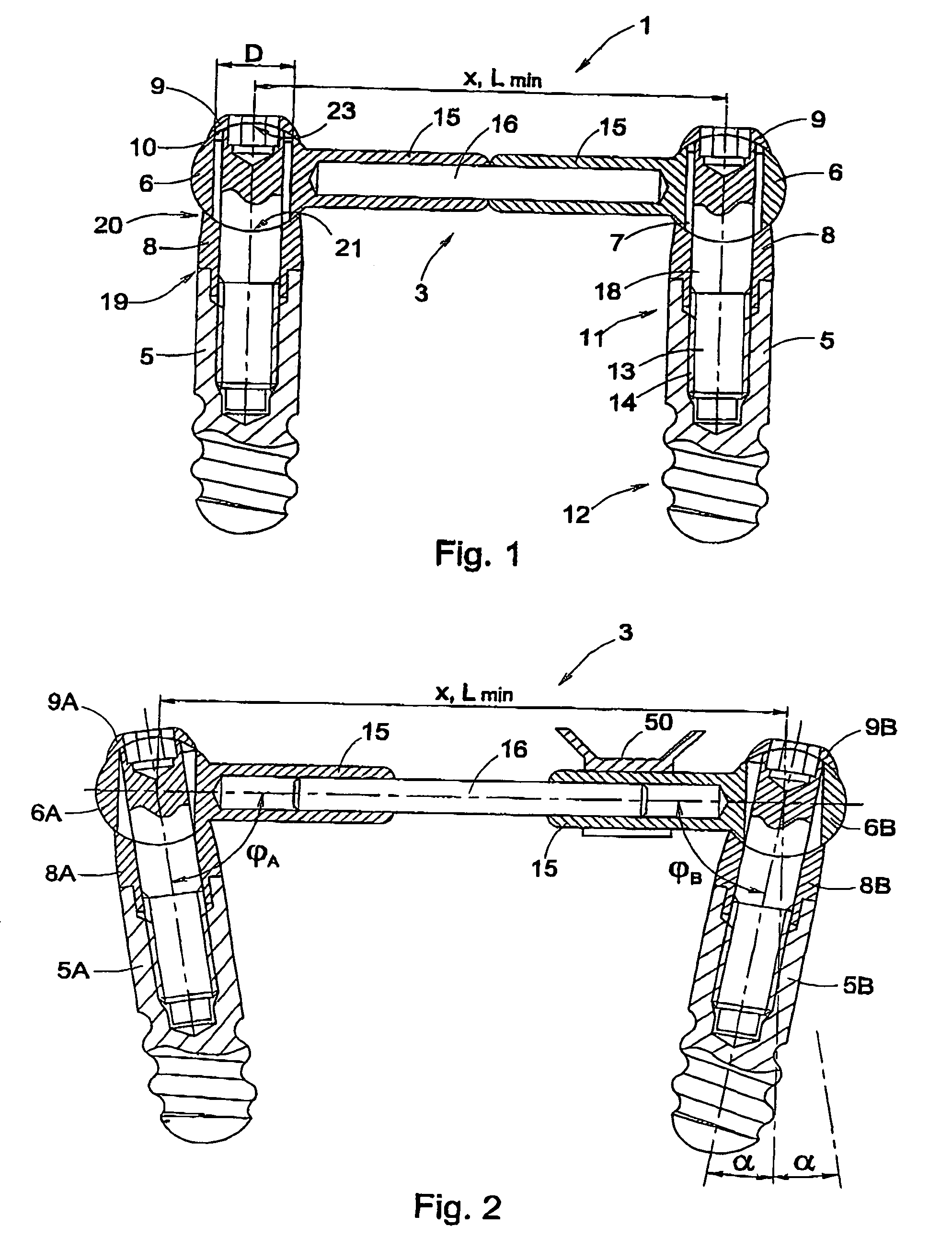 Fastening device for an orthesis or prosthesis