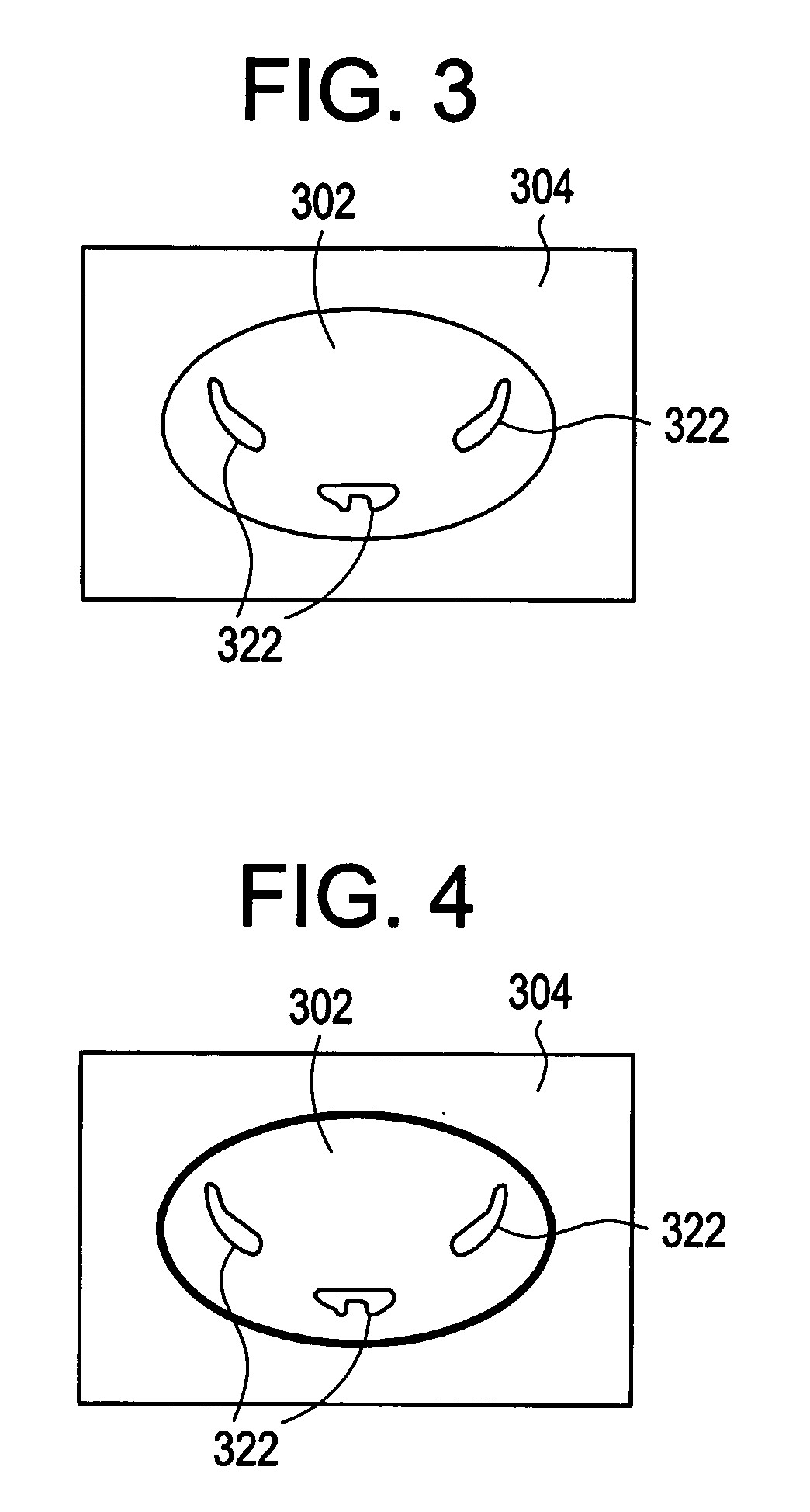 Calcium scoring method and system