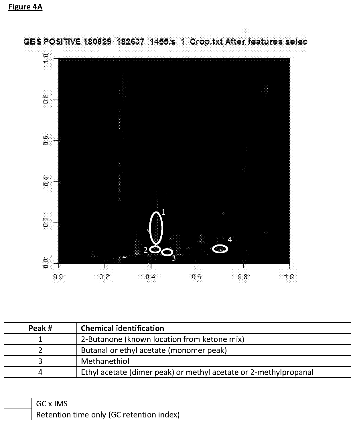 Group b streptococcus infection