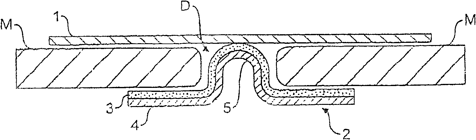 Repair thing of umbilical hernia or umbilical side hernia