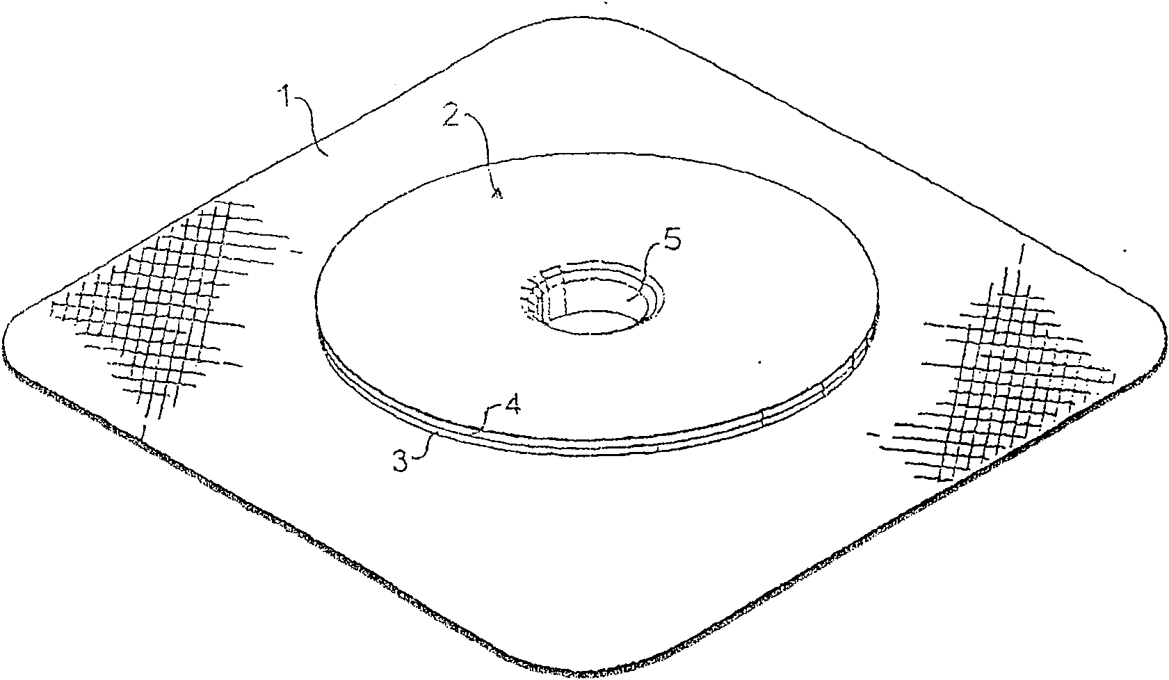 Repair thing of umbilical hernia or umbilical side hernia