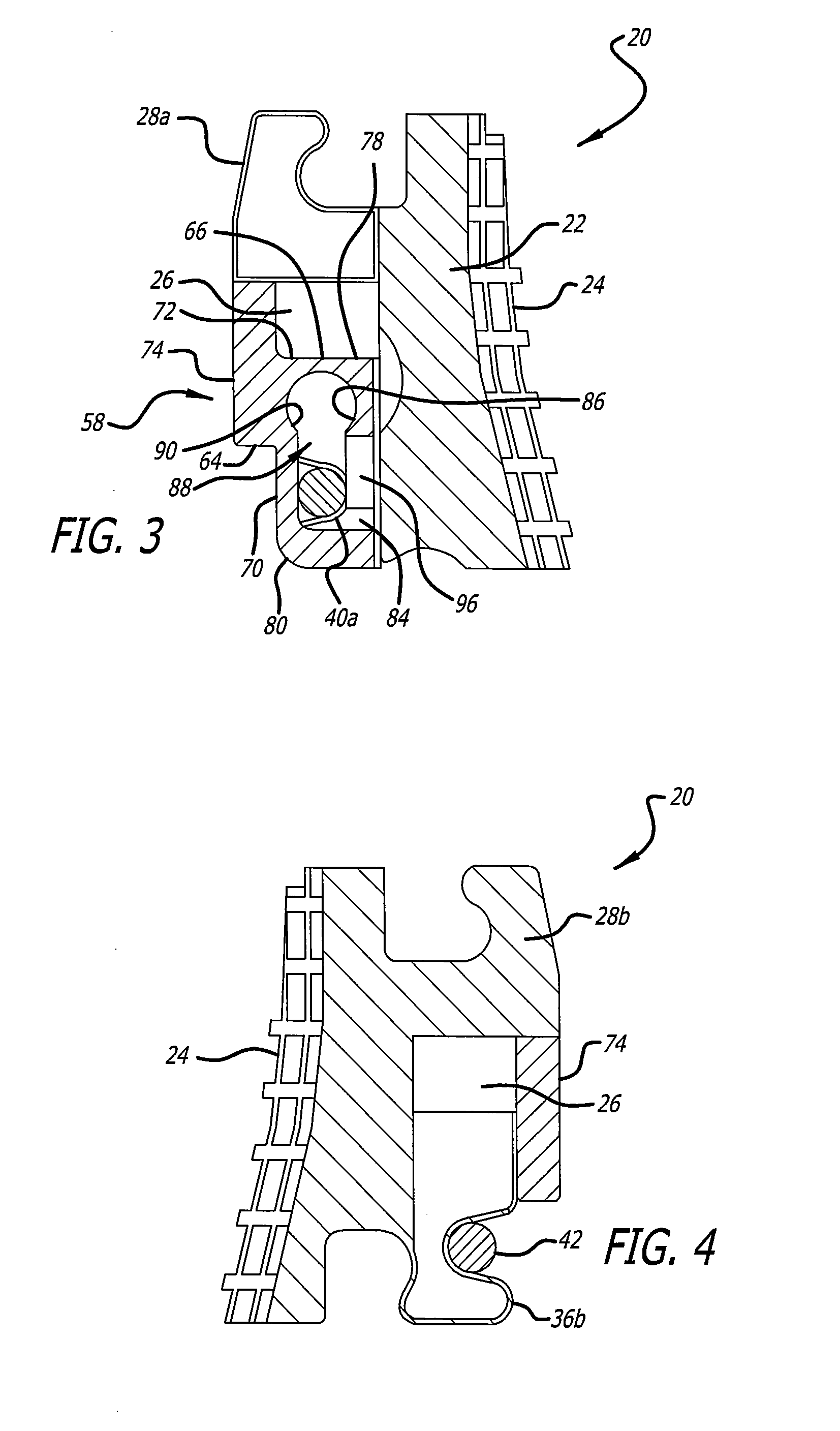 Self-ligating orthodontic bracket