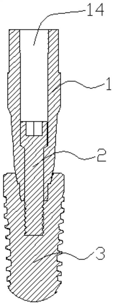 Dental scanning rod