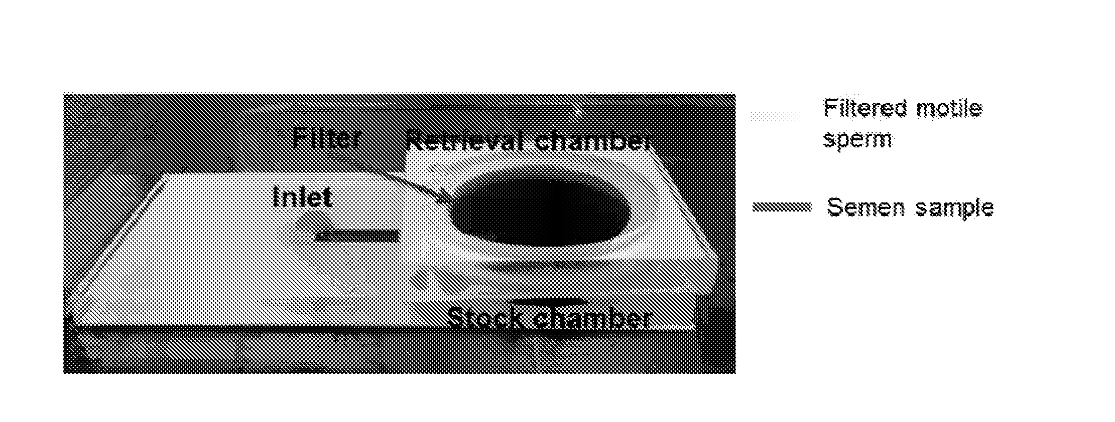 System and method for sperm sorting