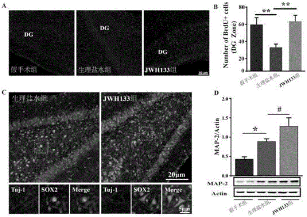 Application of II type cannabinoid receptor stimulant in preparation of medicine for treating newborn cerebral hemorrhage