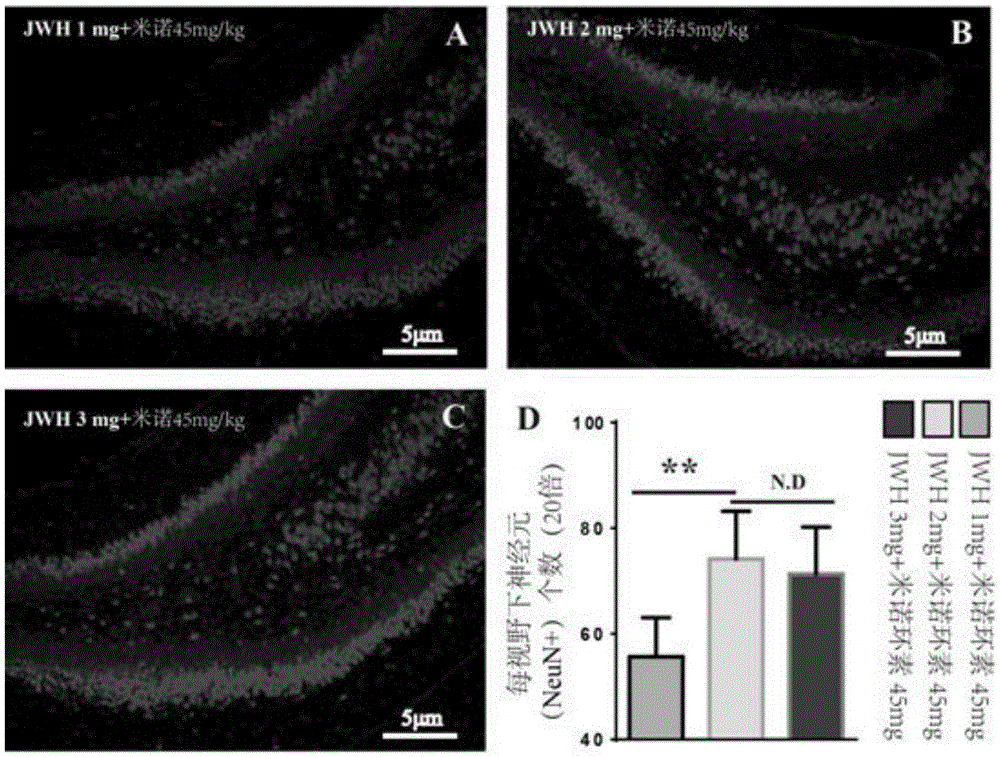 Application of II type cannabinoid receptor stimulant in preparation of medicine for treating newborn cerebral hemorrhage