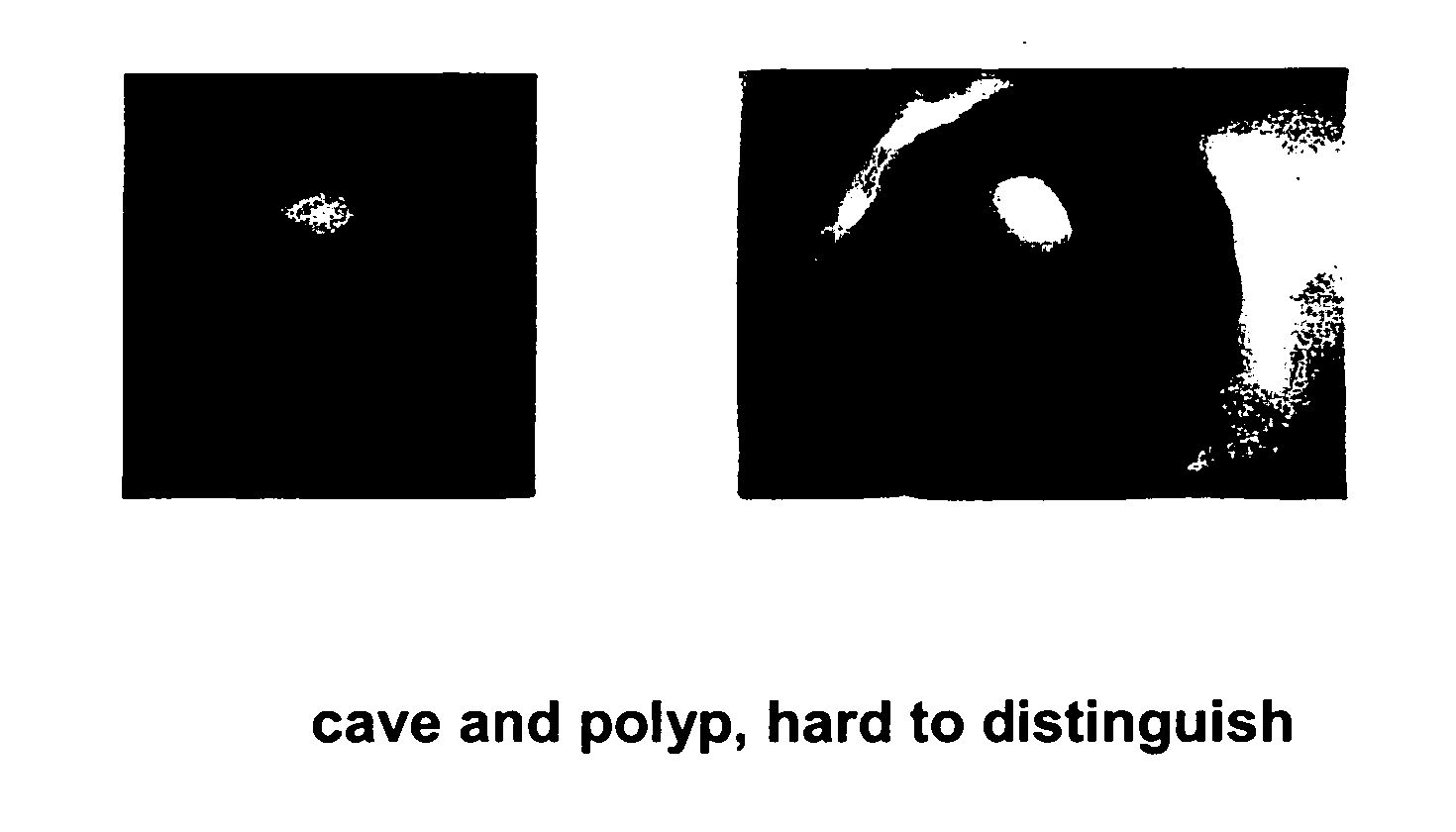 Stereo display of tube-like structures and improved techniques therefor ("stereo display")