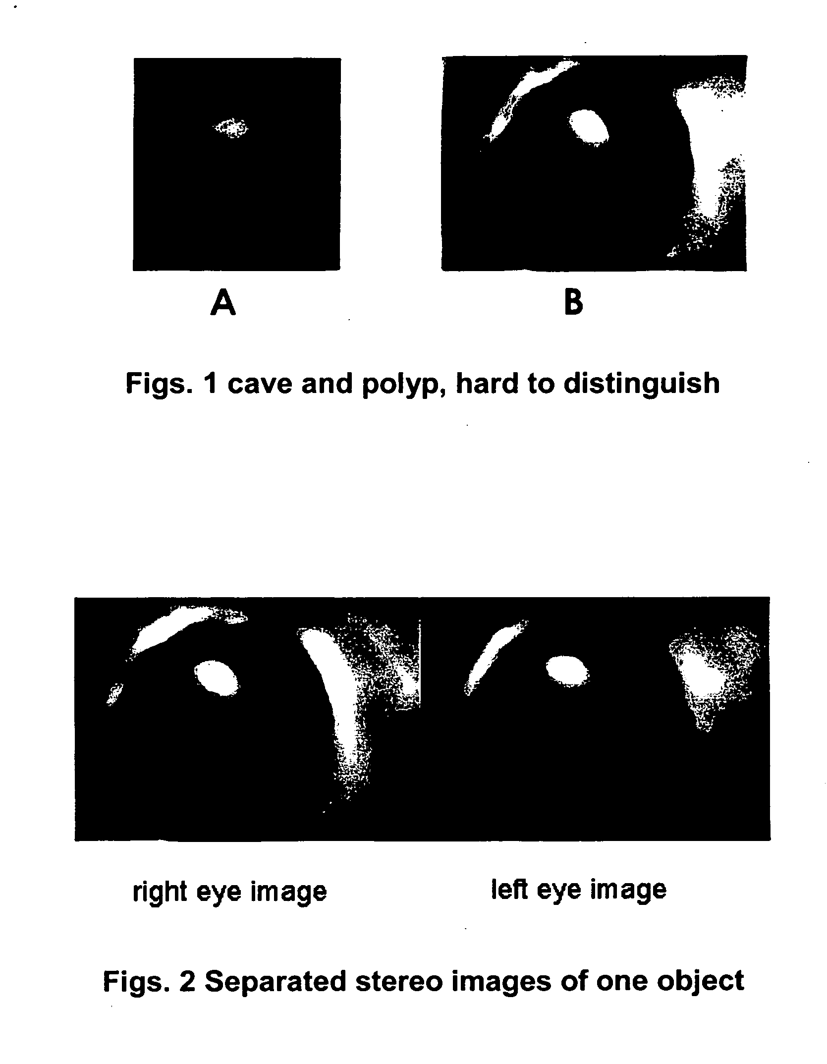 Stereo display of tube-like structures and improved techniques therefor ("stereo display")