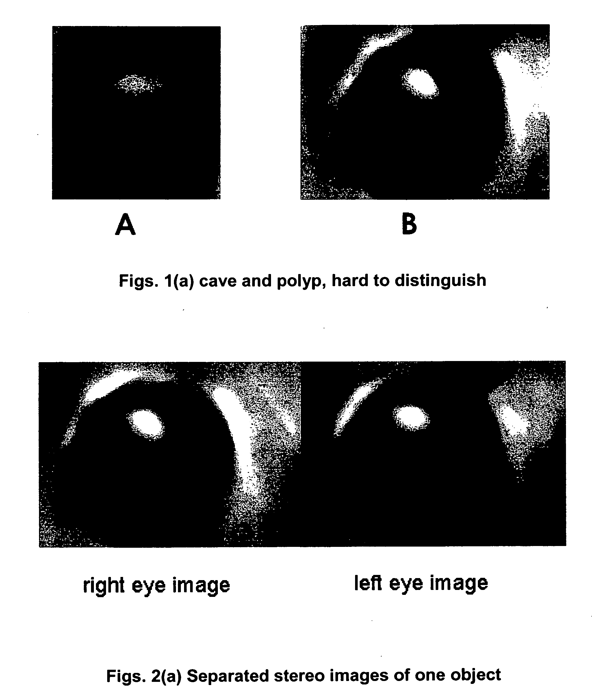 Stereo display of tube-like structures and improved techniques therefor ("stereo display")