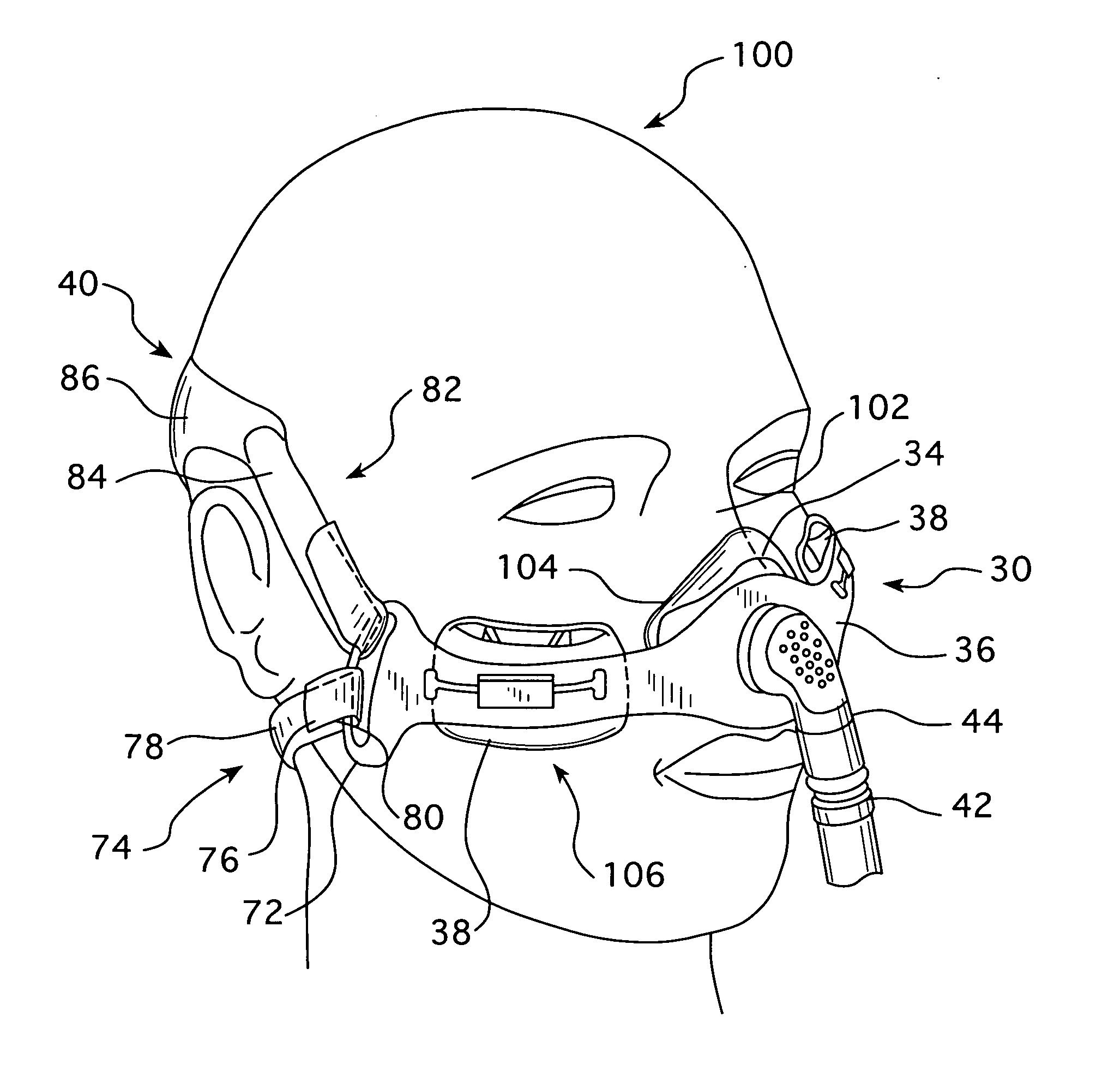 Cheek-mounted patient interface