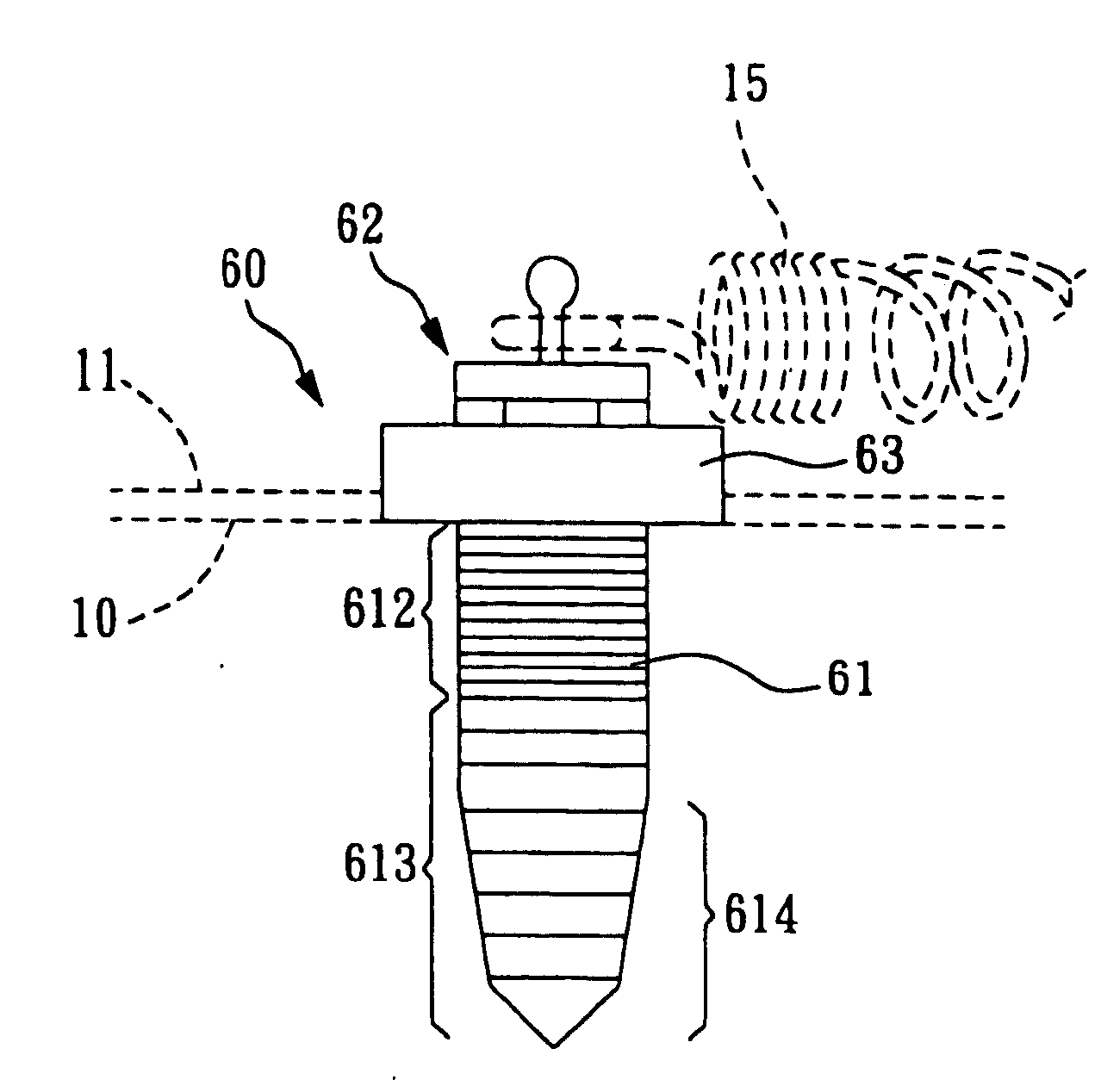 Screw device for orthodontic treatment