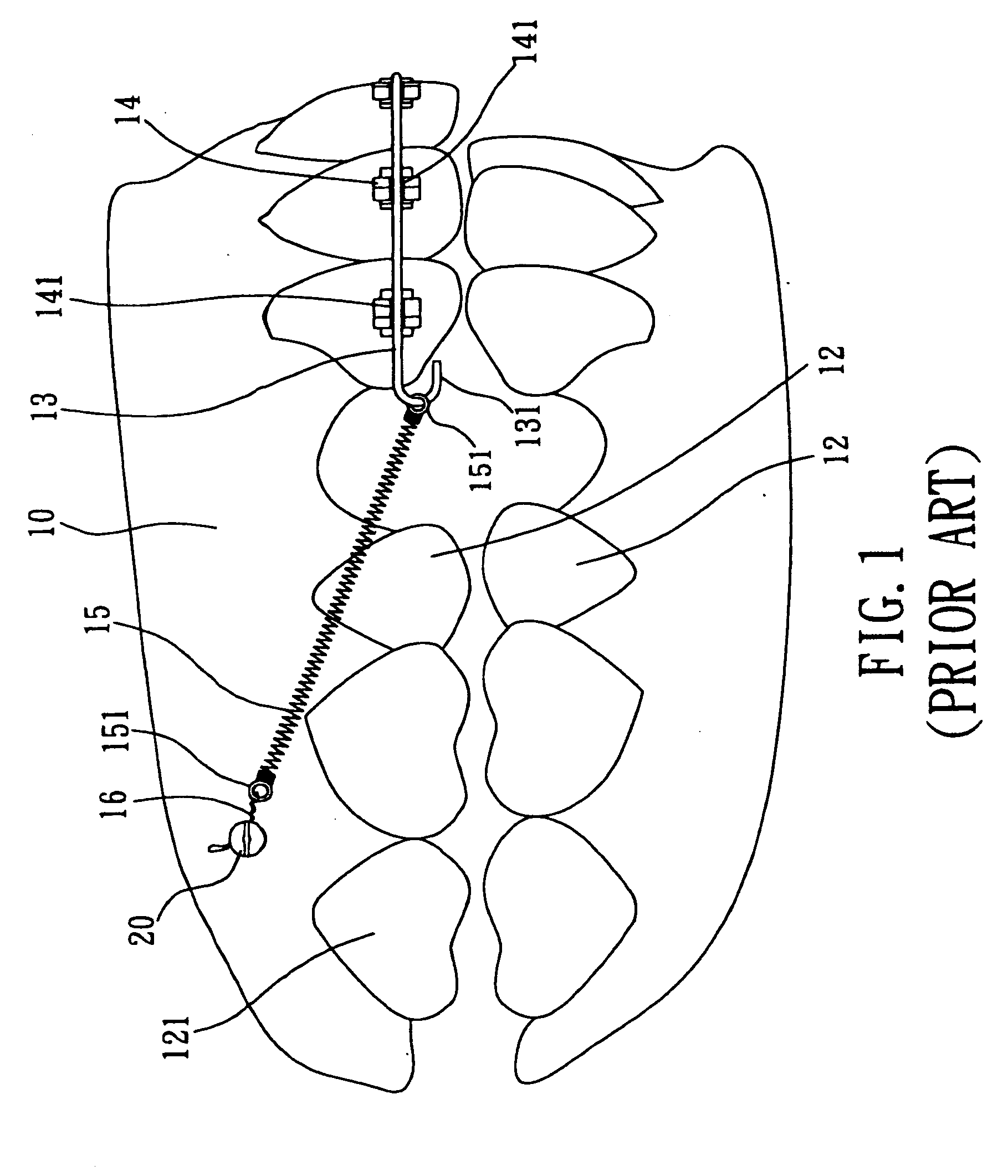 Screw device for orthodontic treatment