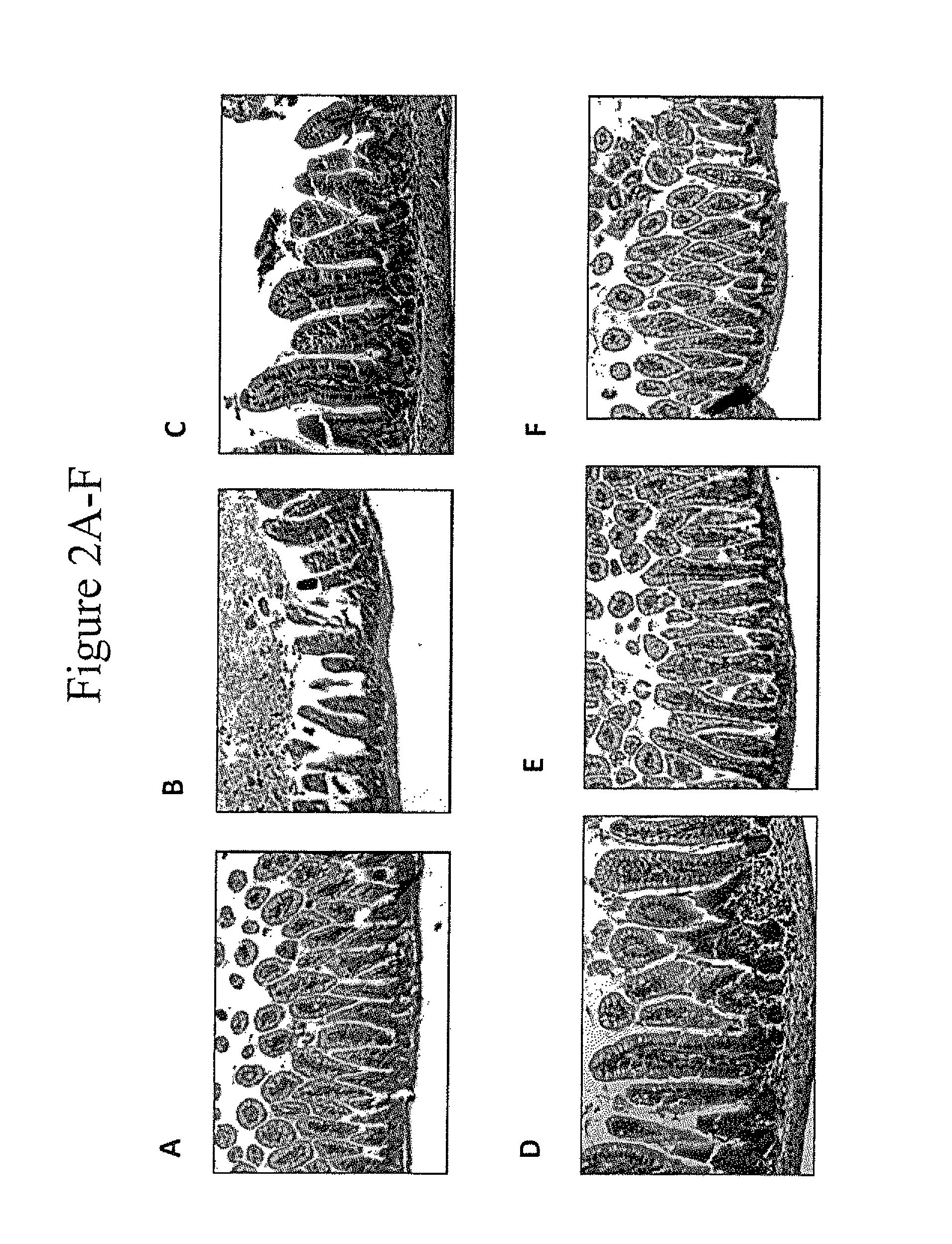 Oral therapy of necrotizing enterocolitis