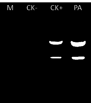 Probes and gene chip for pseudomonas aeruginosa nucleic acid detection, and kit