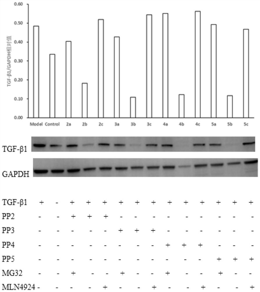 Compound for degrading TGF-beta1 through targeted ubiquitination, and preparation method and application thereof