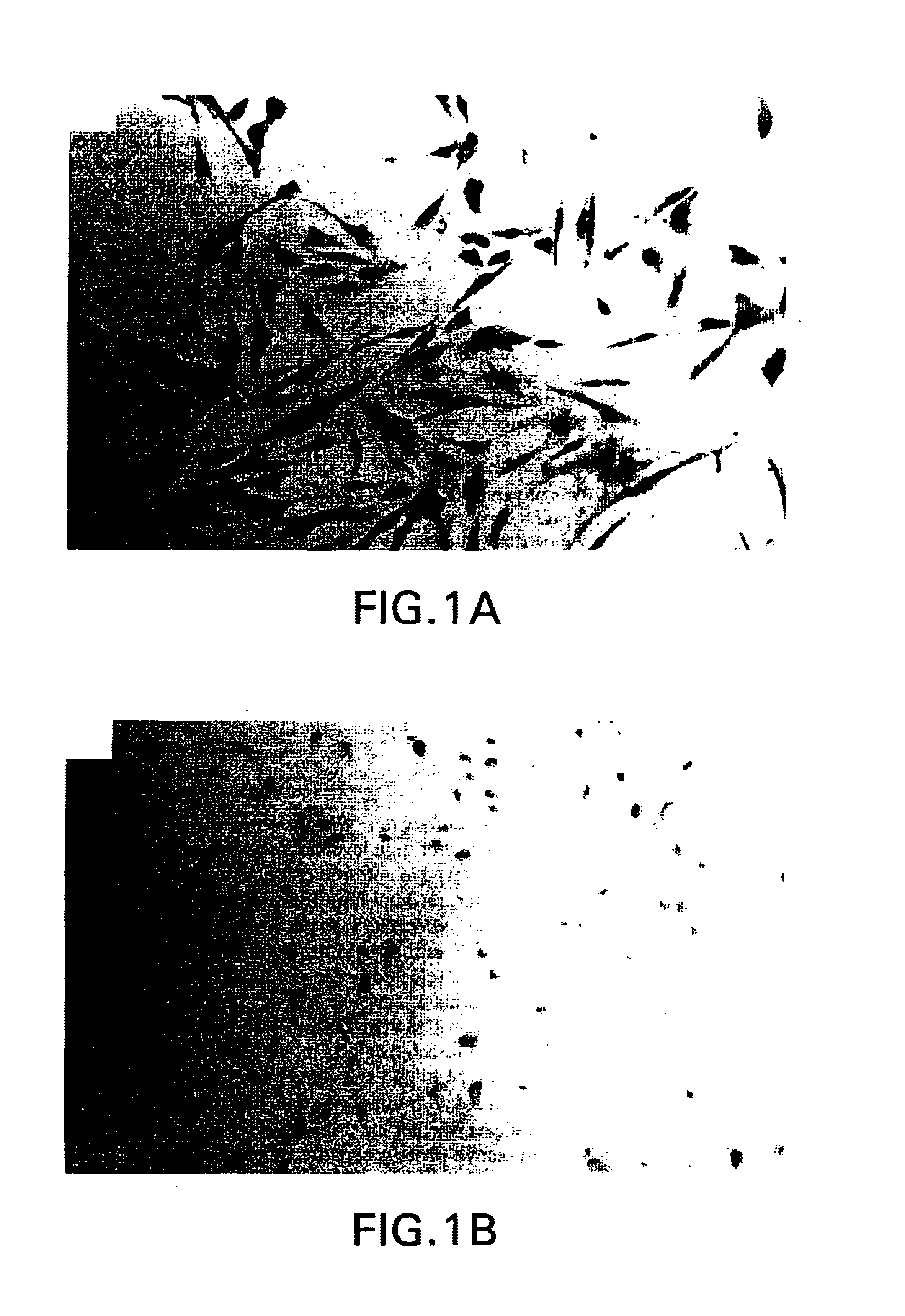 Method of inducing vasodilation and treating pulmonary hypertension using adenoviral-mediated transfer of the nitric oxide synthase gene