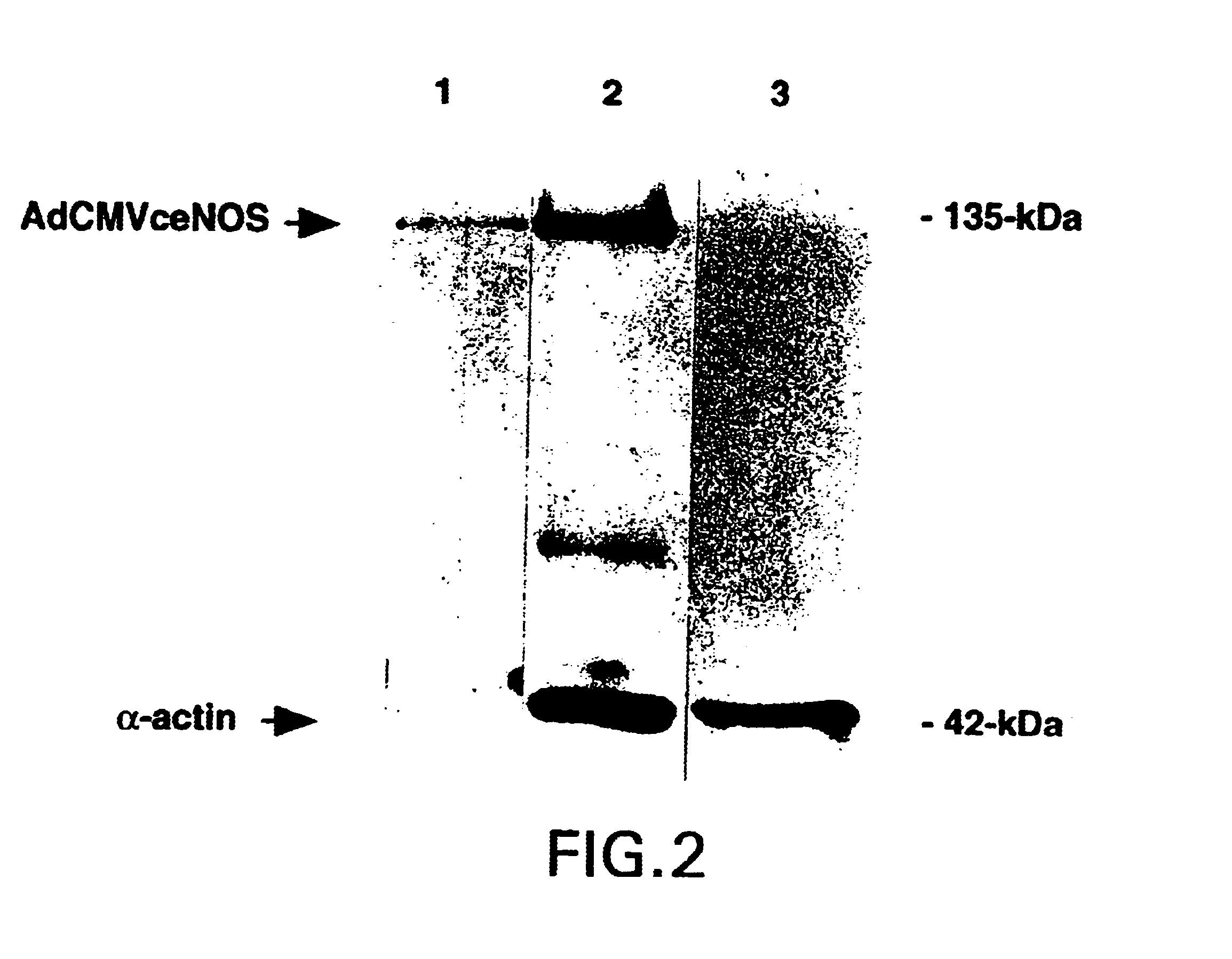 Method of inducing vasodilation and treating pulmonary hypertension using adenoviral-mediated transfer of the nitric oxide synthase gene