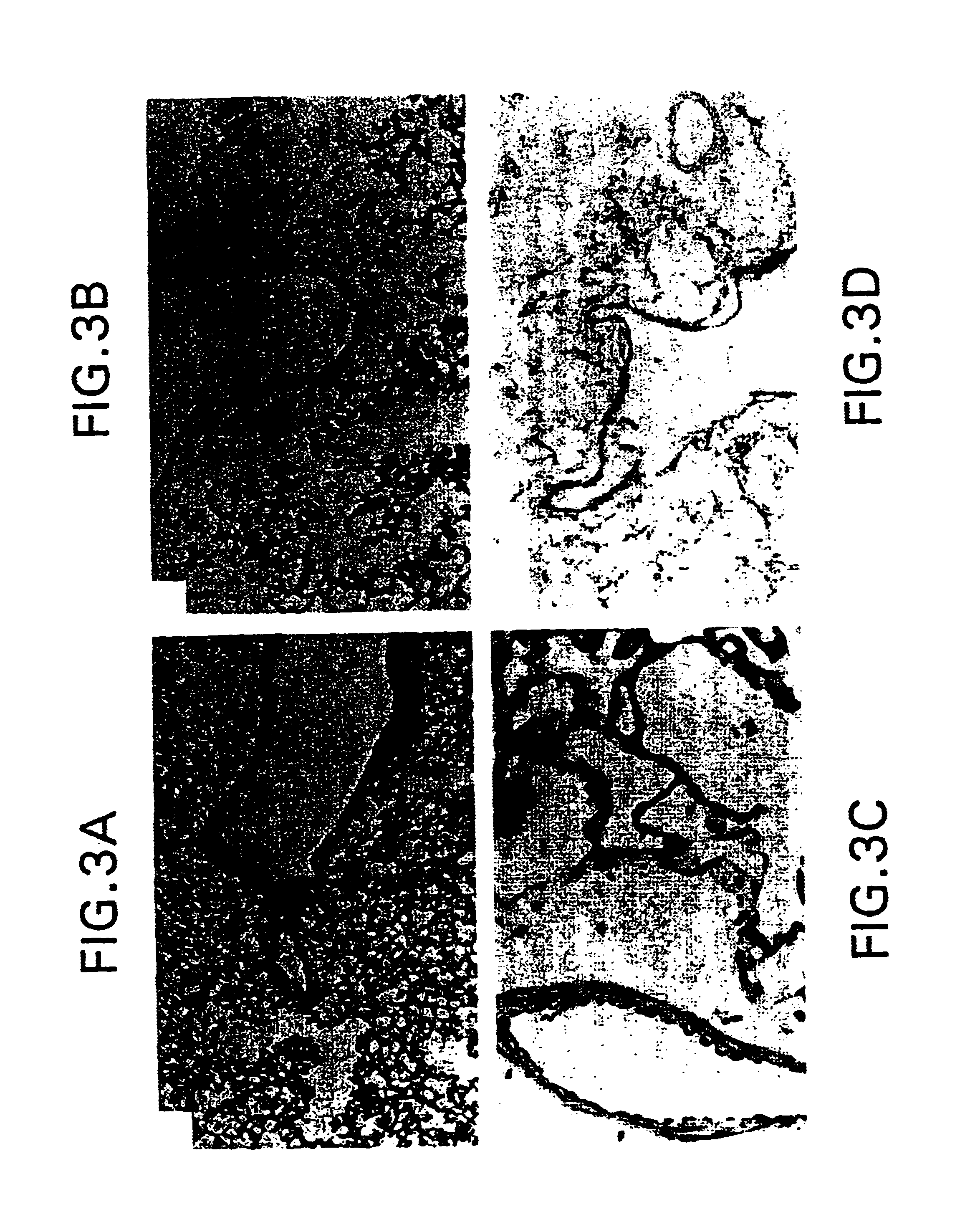 Method of inducing vasodilation and treating pulmonary hypertension using adenoviral-mediated transfer of the nitric oxide synthase gene