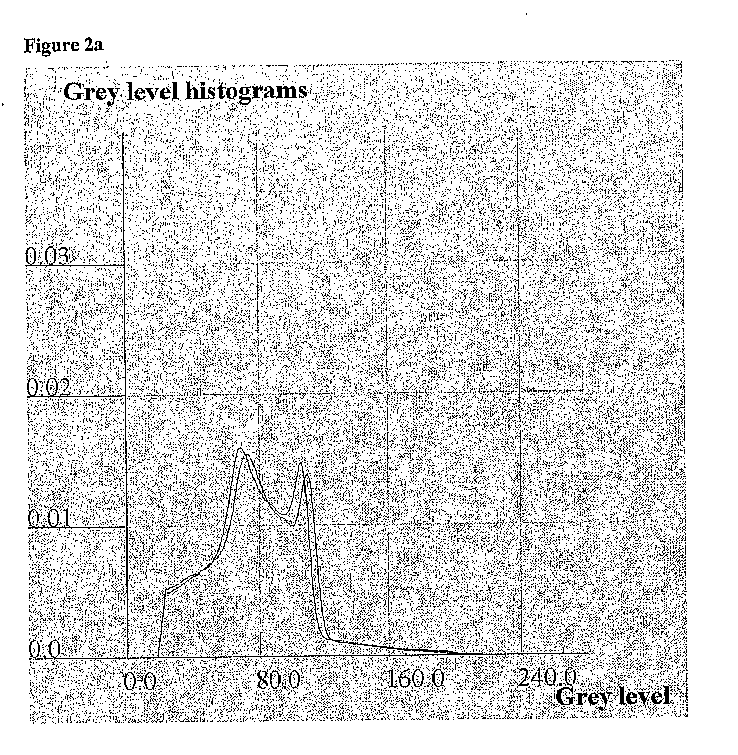 Method and Apparatus for Determining Asymmetry in an Image